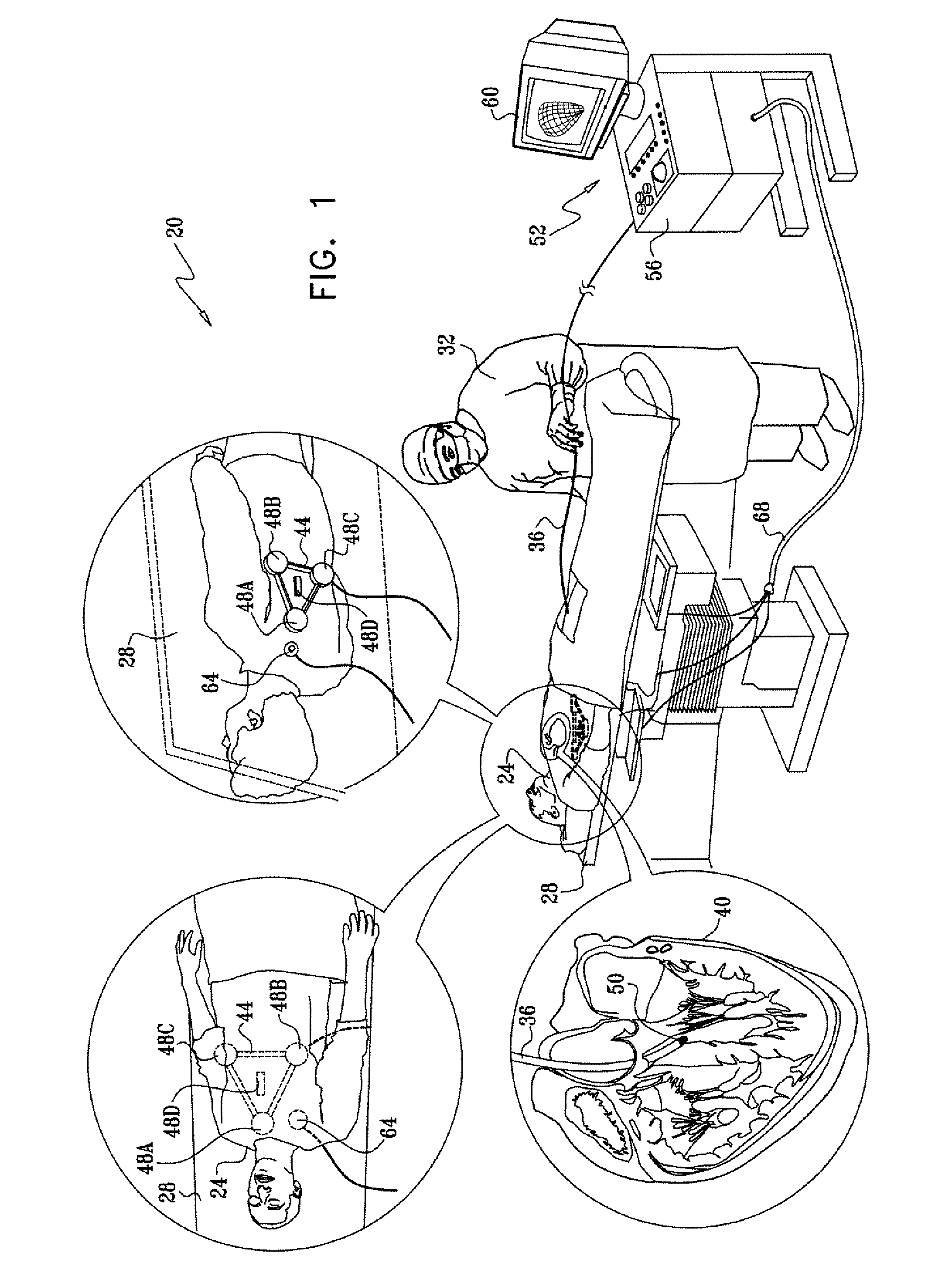 Low-profile location pad