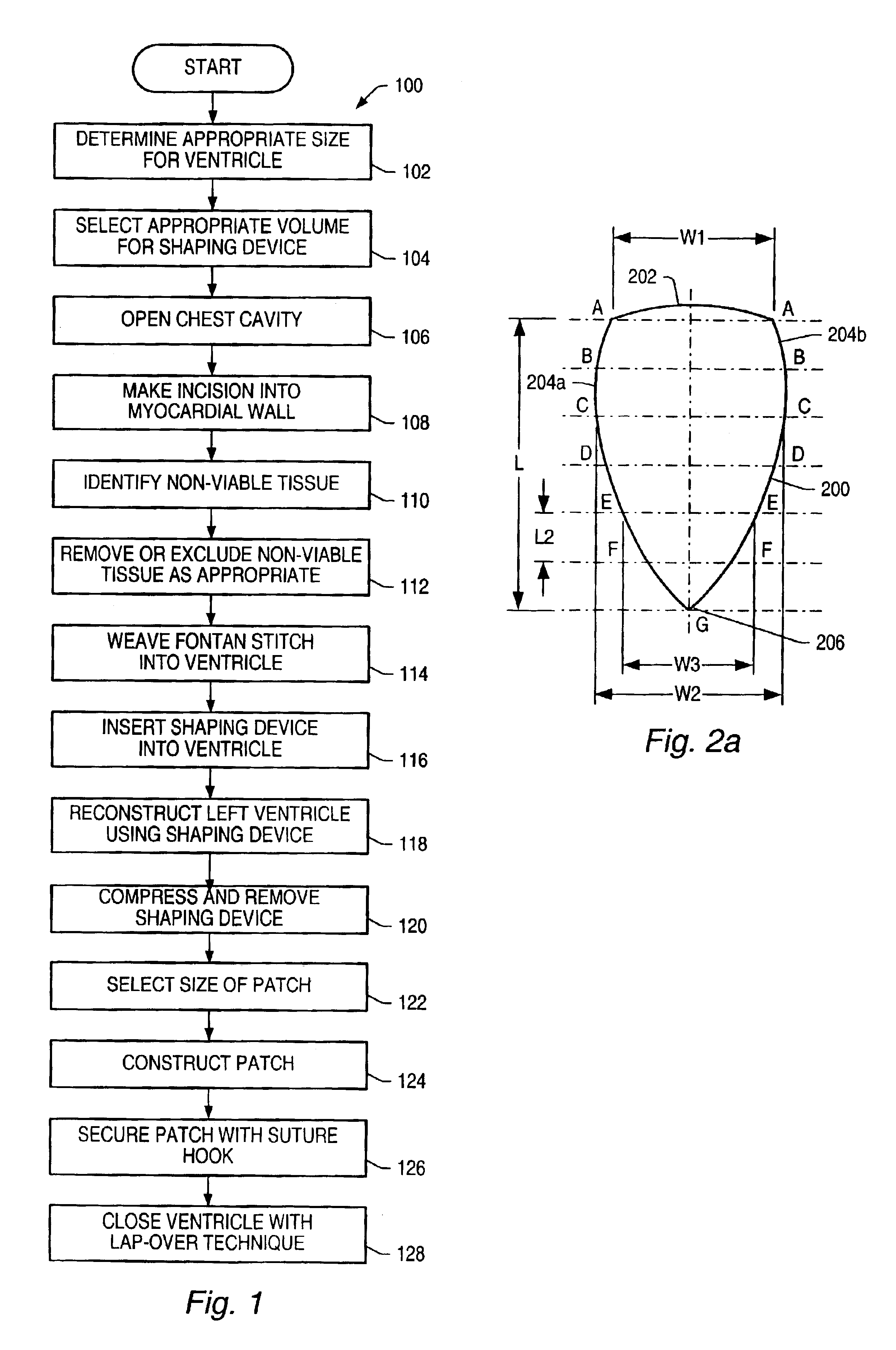 Kit and method for use during ventricular restoration