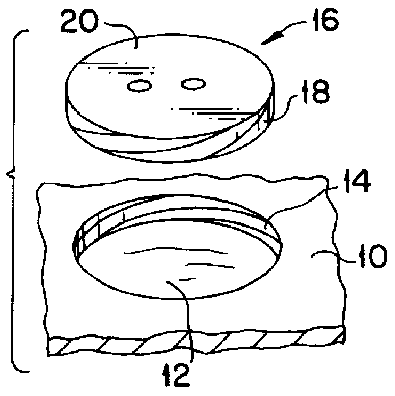 Apparatus for use in grafting articular cartilage