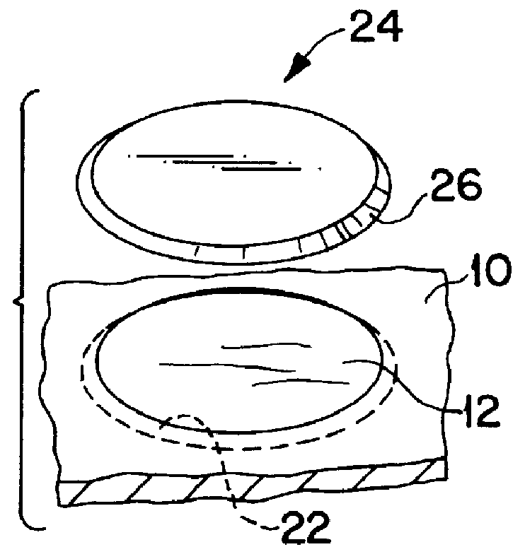 Apparatus for use in grafting articular cartilage