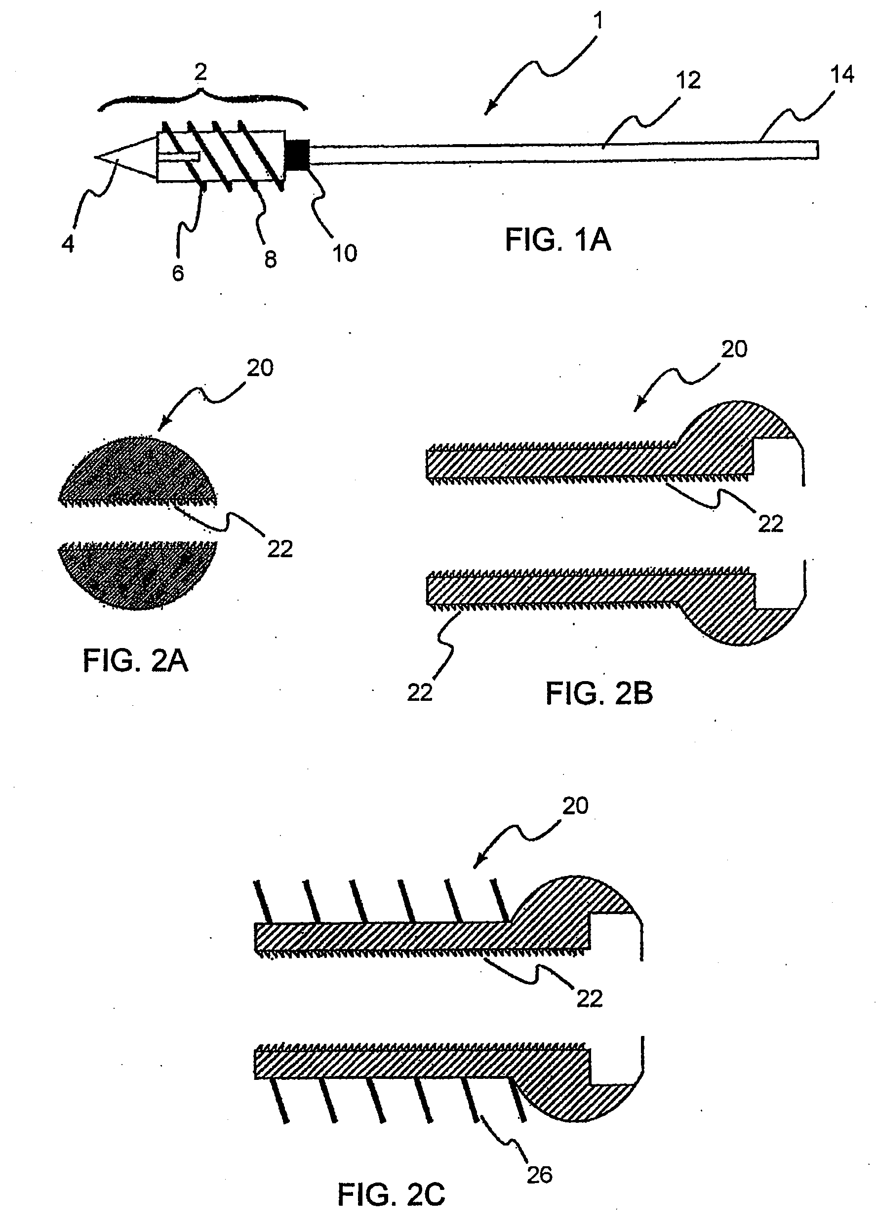 Stabilization system and method for the fixation of bone fractures