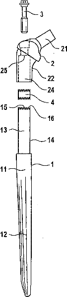 Modular femur-head prosthesis