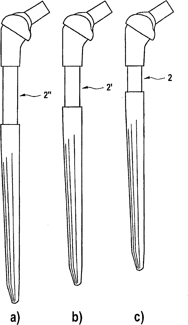 Modular femur-head prosthesis