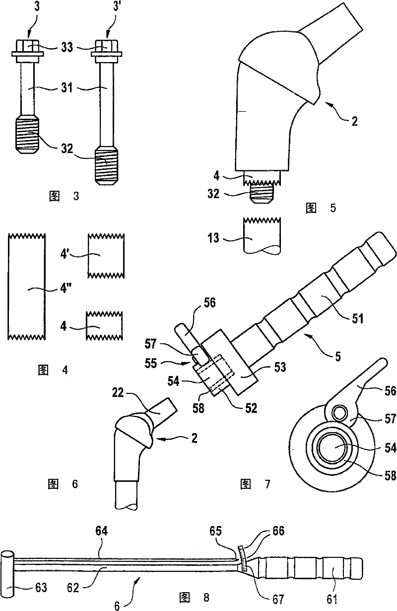 Modular femur-head prosthesis