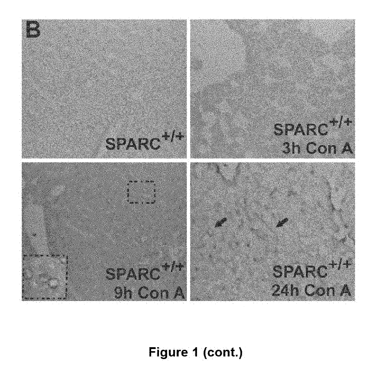 SPARC (secreted protein, acidic and rich in cysteine), a new target for the treatment and prevention of acute liver failure