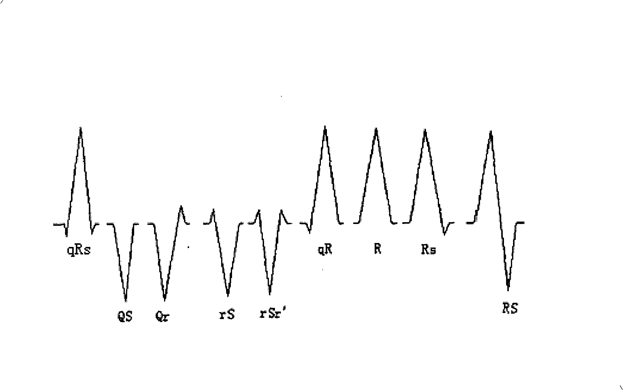 Method and apparatus for electrocardiogram recognition and specification