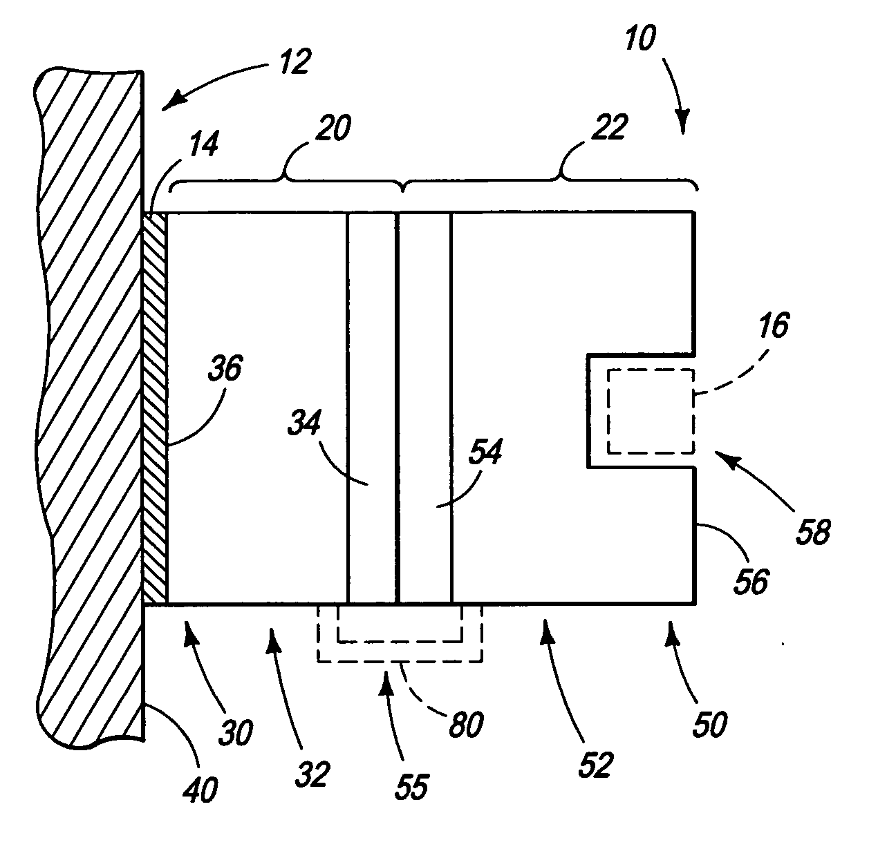 Reusable multi-piece orthodontic appliances