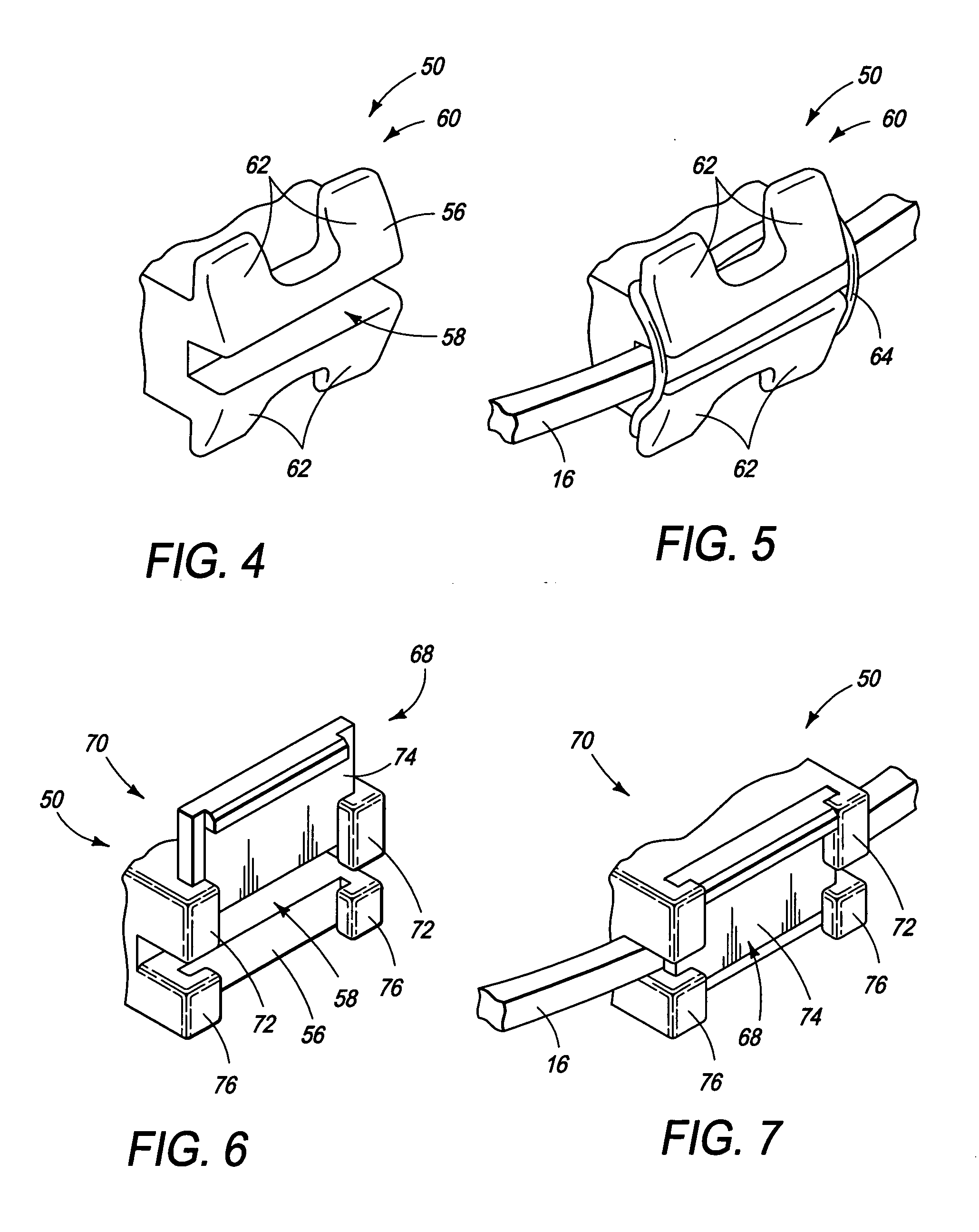 Reusable multi-piece orthodontic appliances