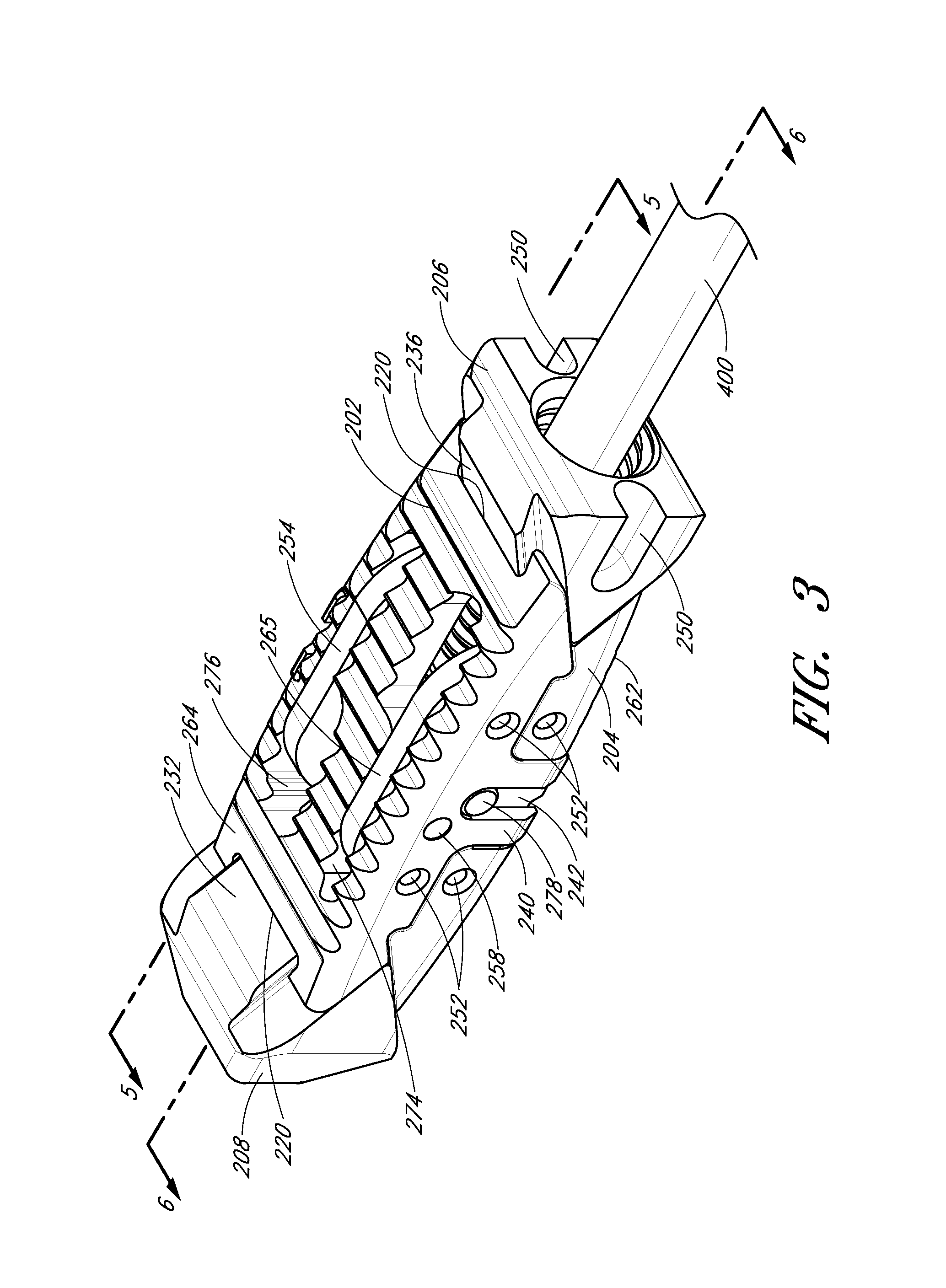 Intervertebral implant