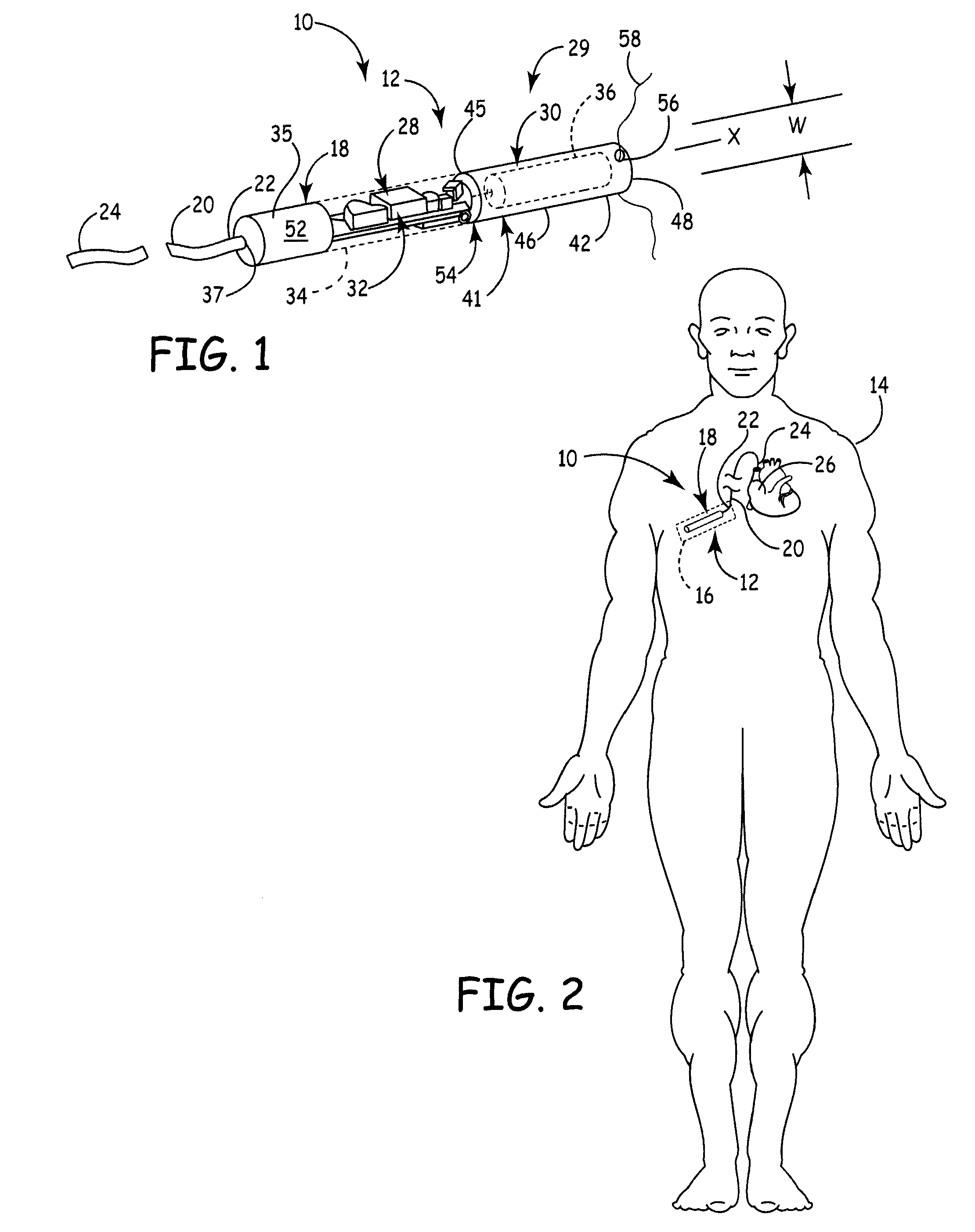 Elongate battery for implantable medical device