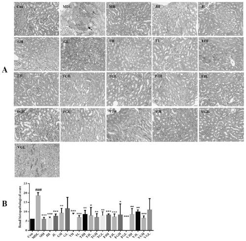 Composition for preventing and treating diabetic nephropathy and application thereof