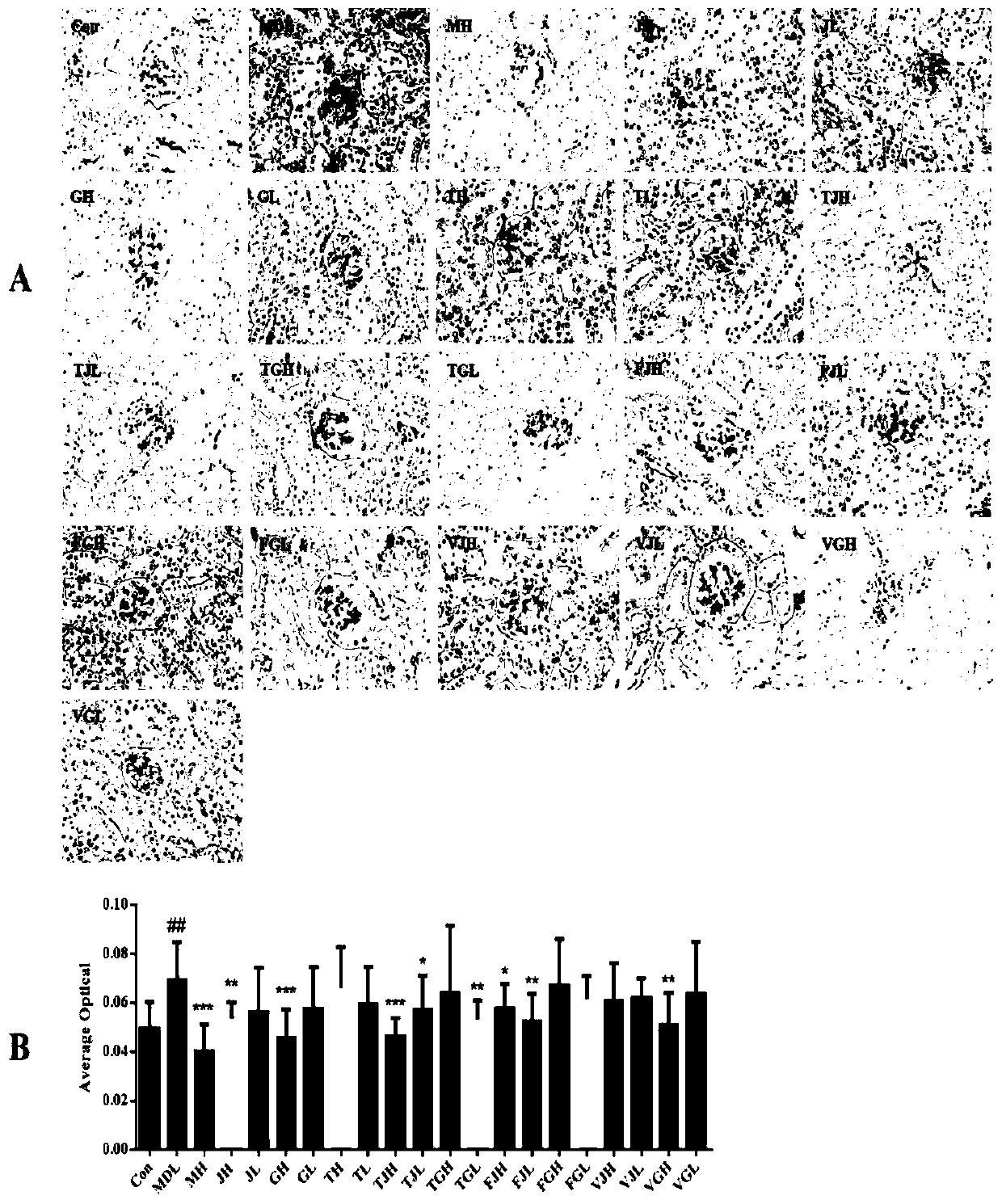 Composition for preventing and treating diabetic nephropathy and application thereof