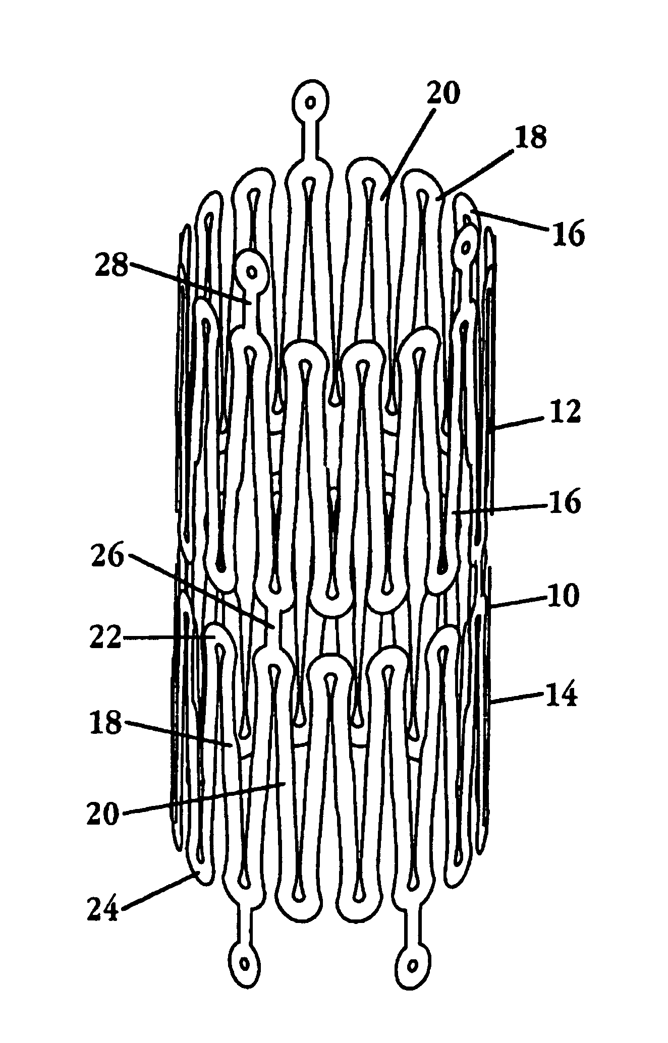 Neurovascular stent and method