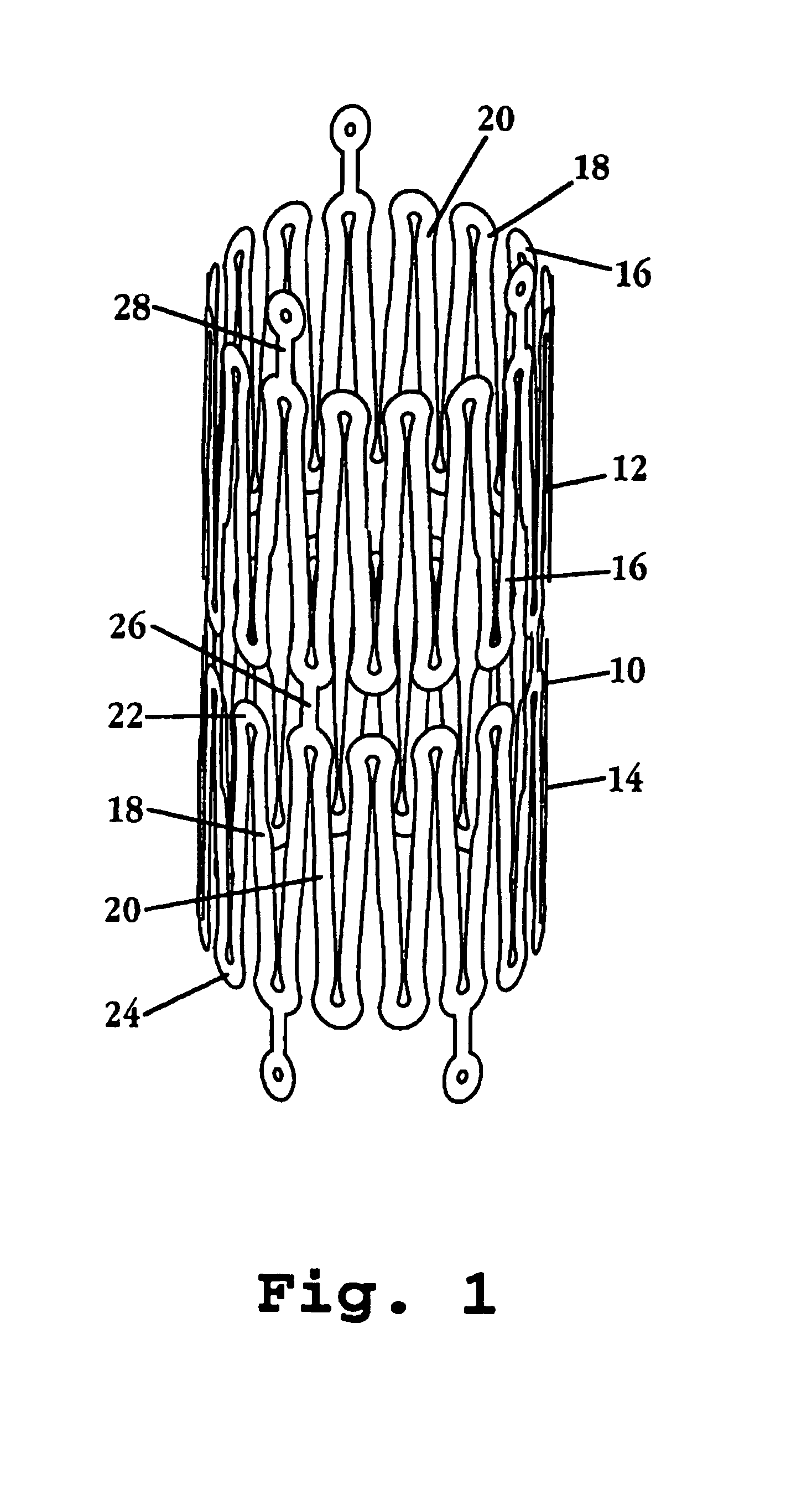 Neurovascular stent and method