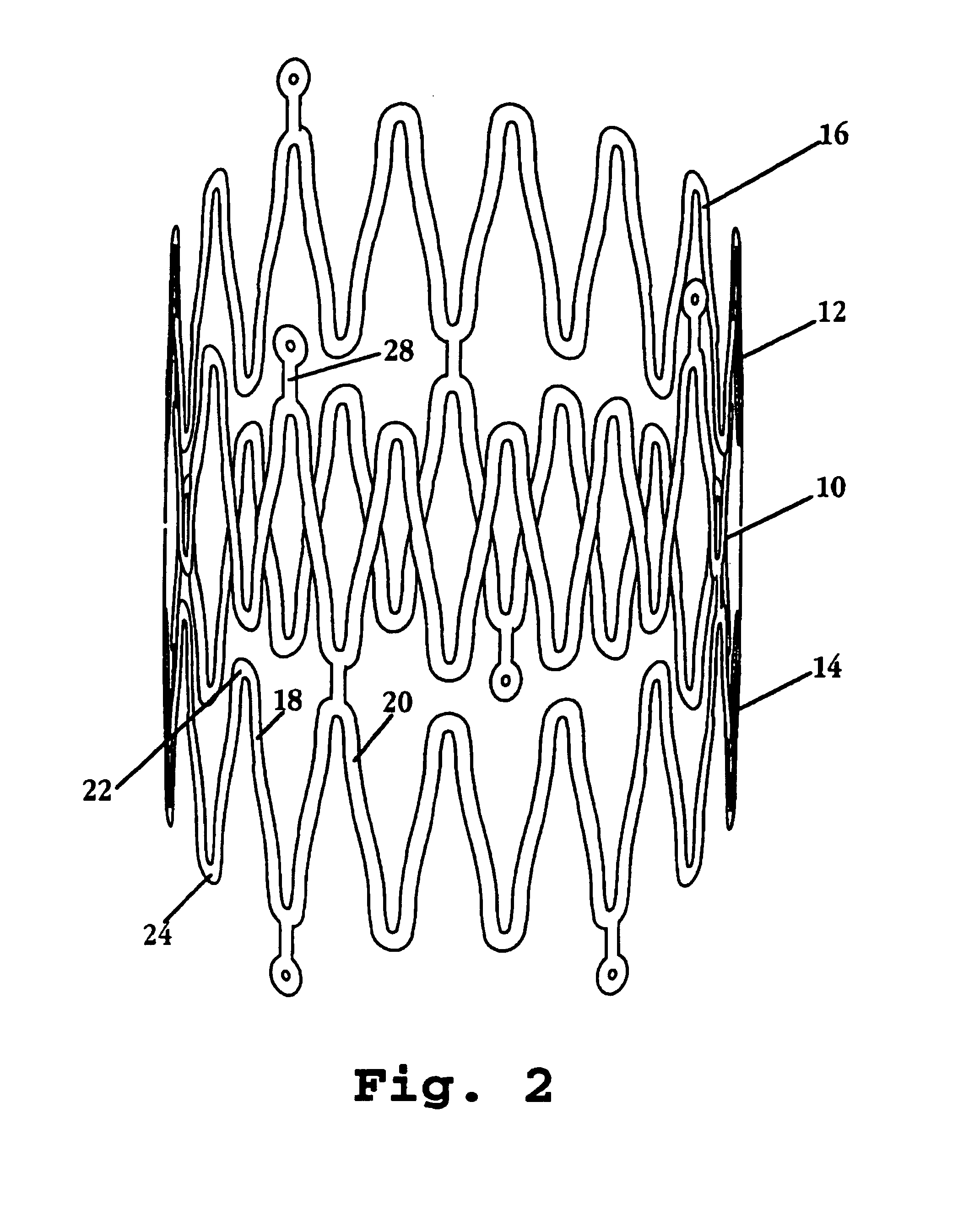 Neurovascular stent and method