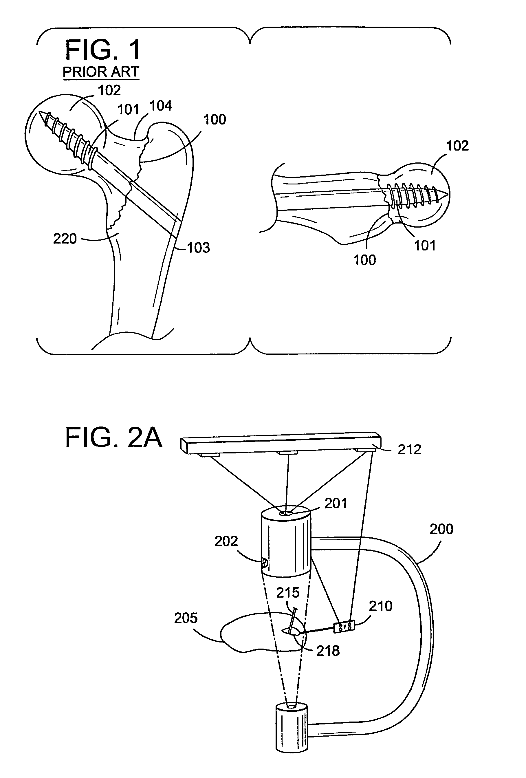 Fluoroscopic image guided orthopaedic surgery system with intraoperative registration