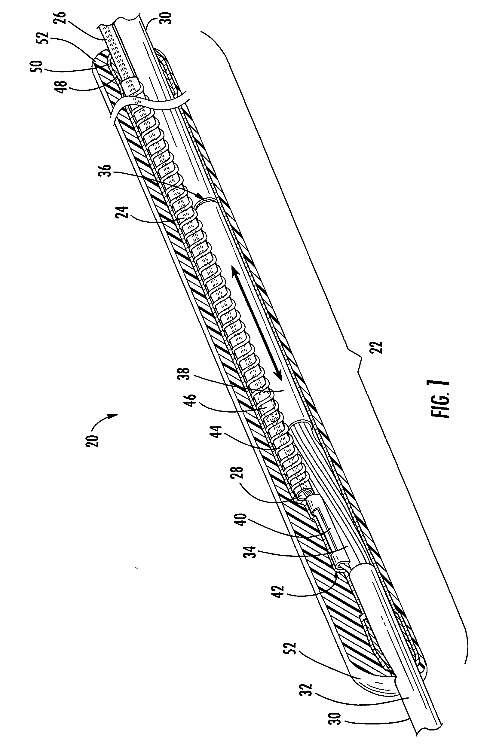 Distribution cable assembly having overmolded mid-span access location