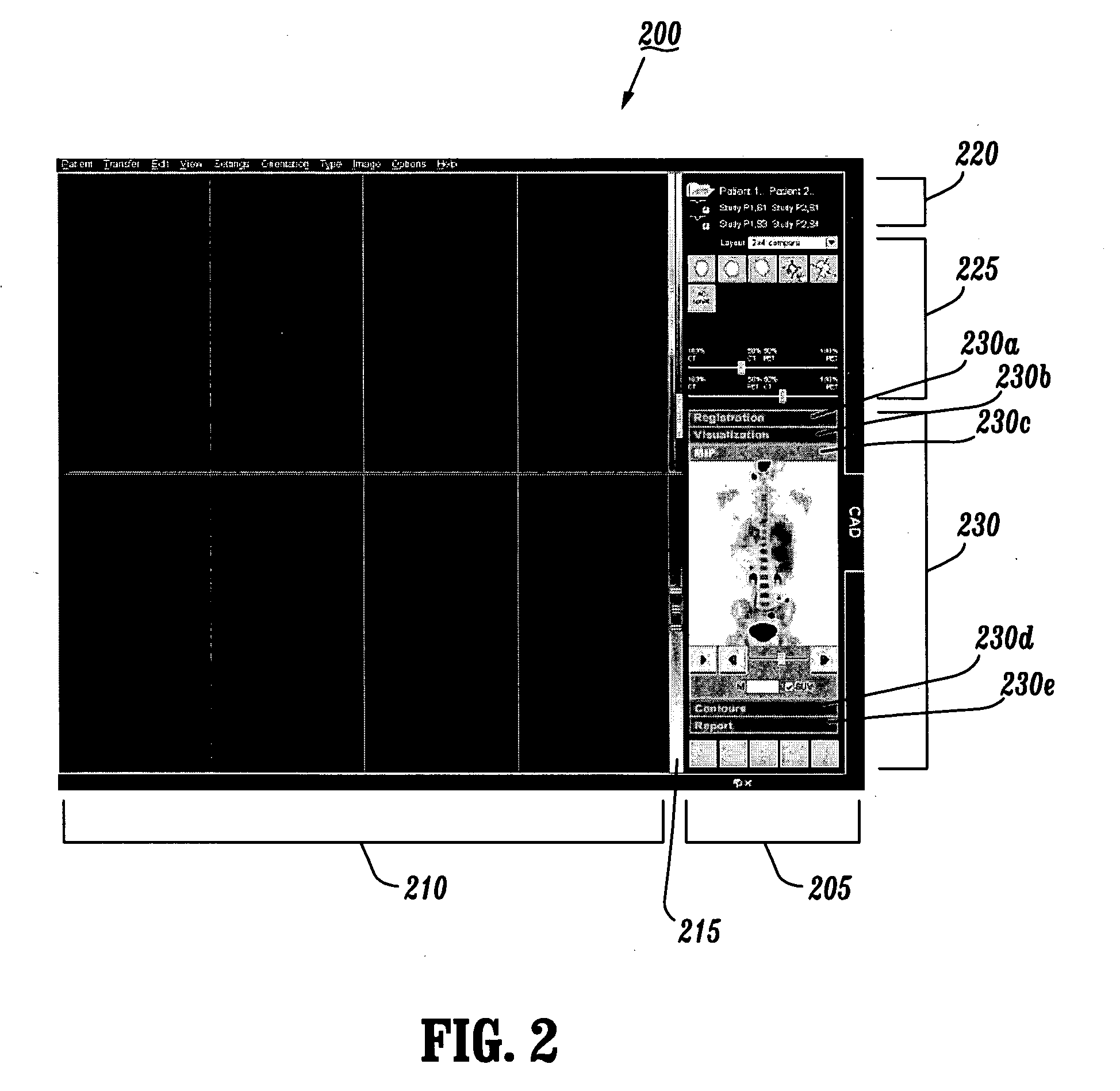 System and method for monitoring disease progression or response to therapy using multi-modal visualization