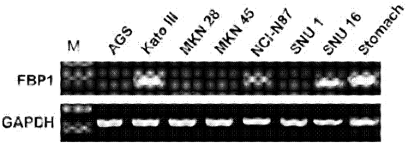 Application of FBP1 (fructose-1,6-bisphosphatase 1) gene