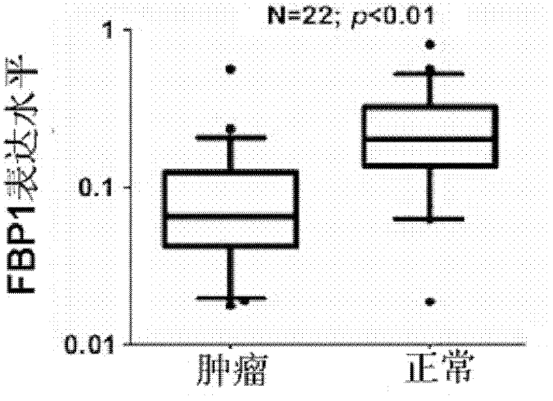 Application of FBP1 (fructose-1,6-bisphosphatase 1) gene