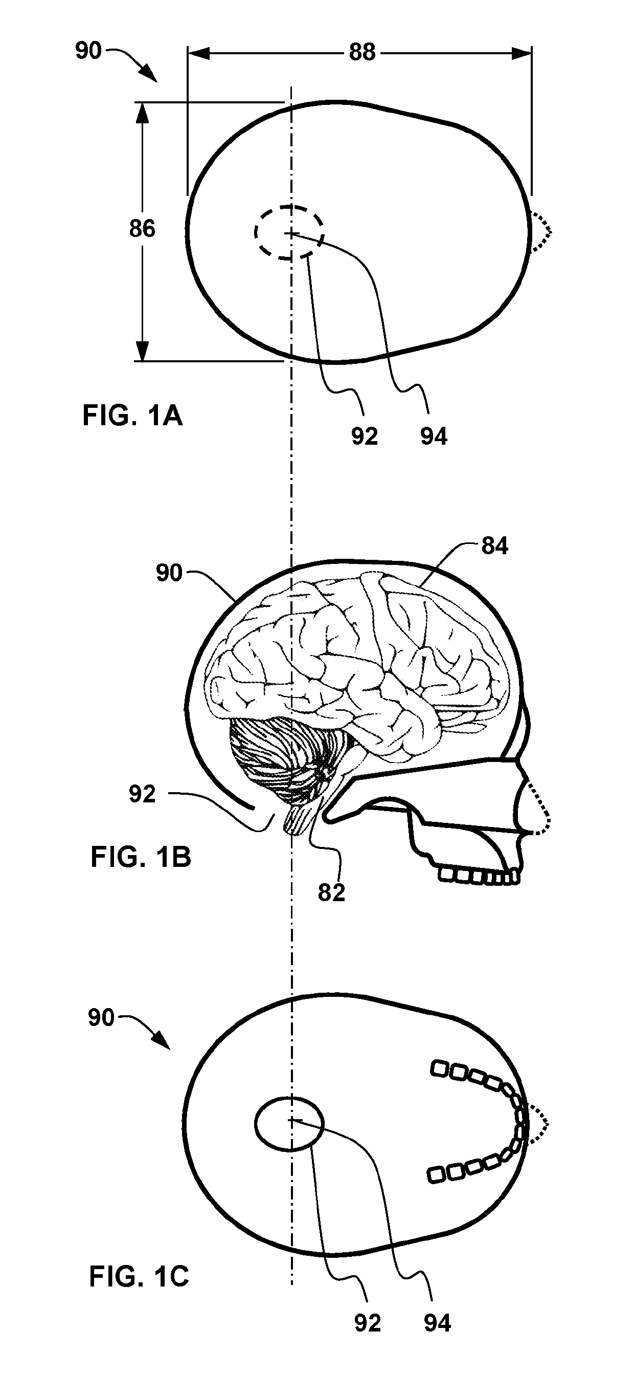 Ocular-performance-based head impact measurement applied to rotationally-centered impact mitigation systems and methods