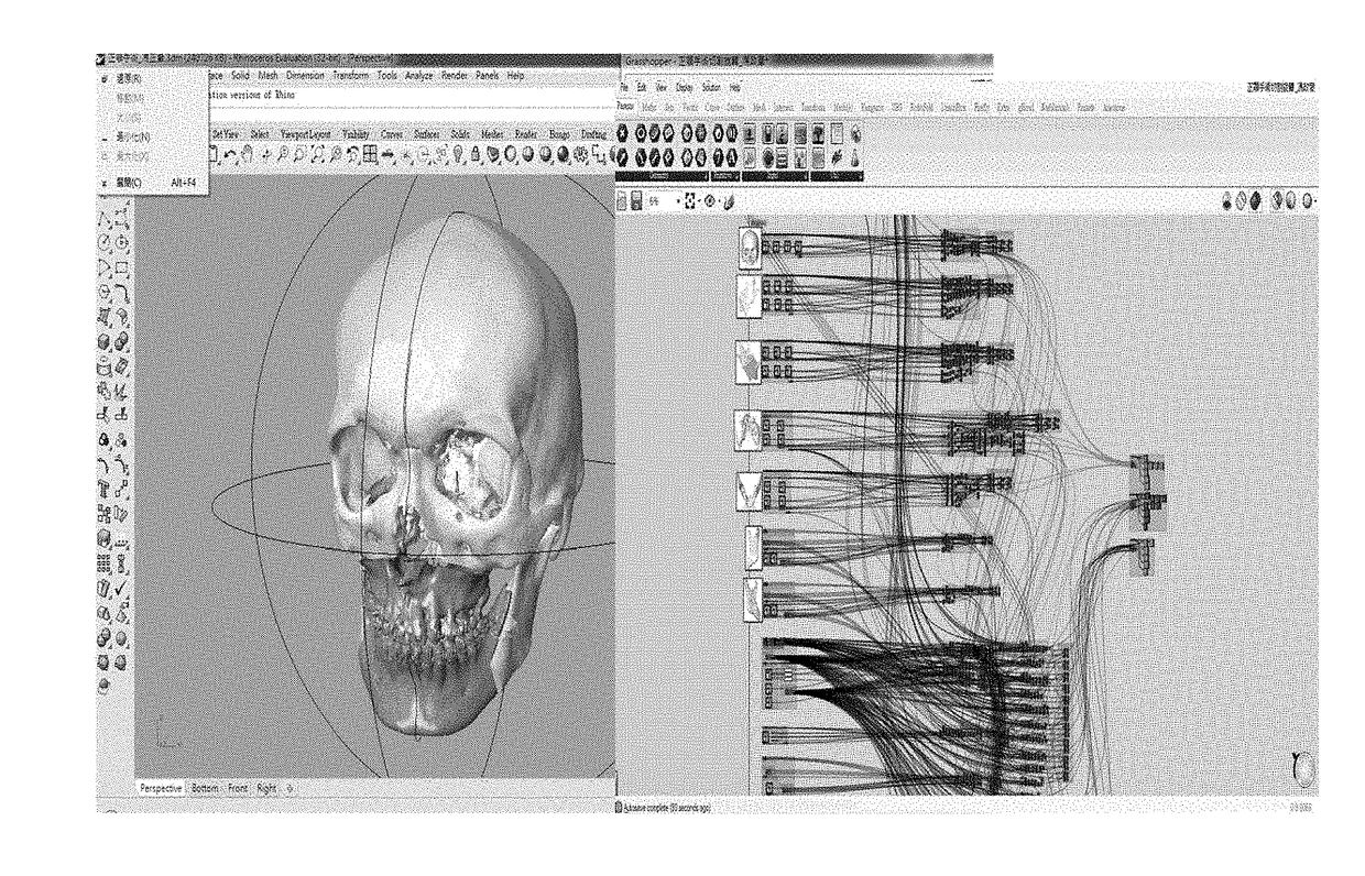 Image Correction Design System and Method for Oral and Maxillofacial Surgery