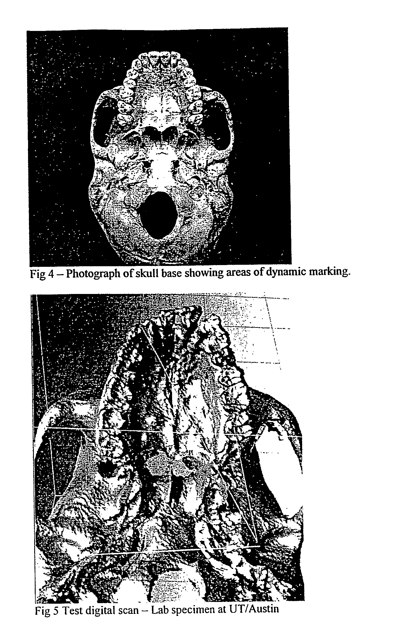 Method and system for morphometric analysis of human dental occlusal function and uses thereof