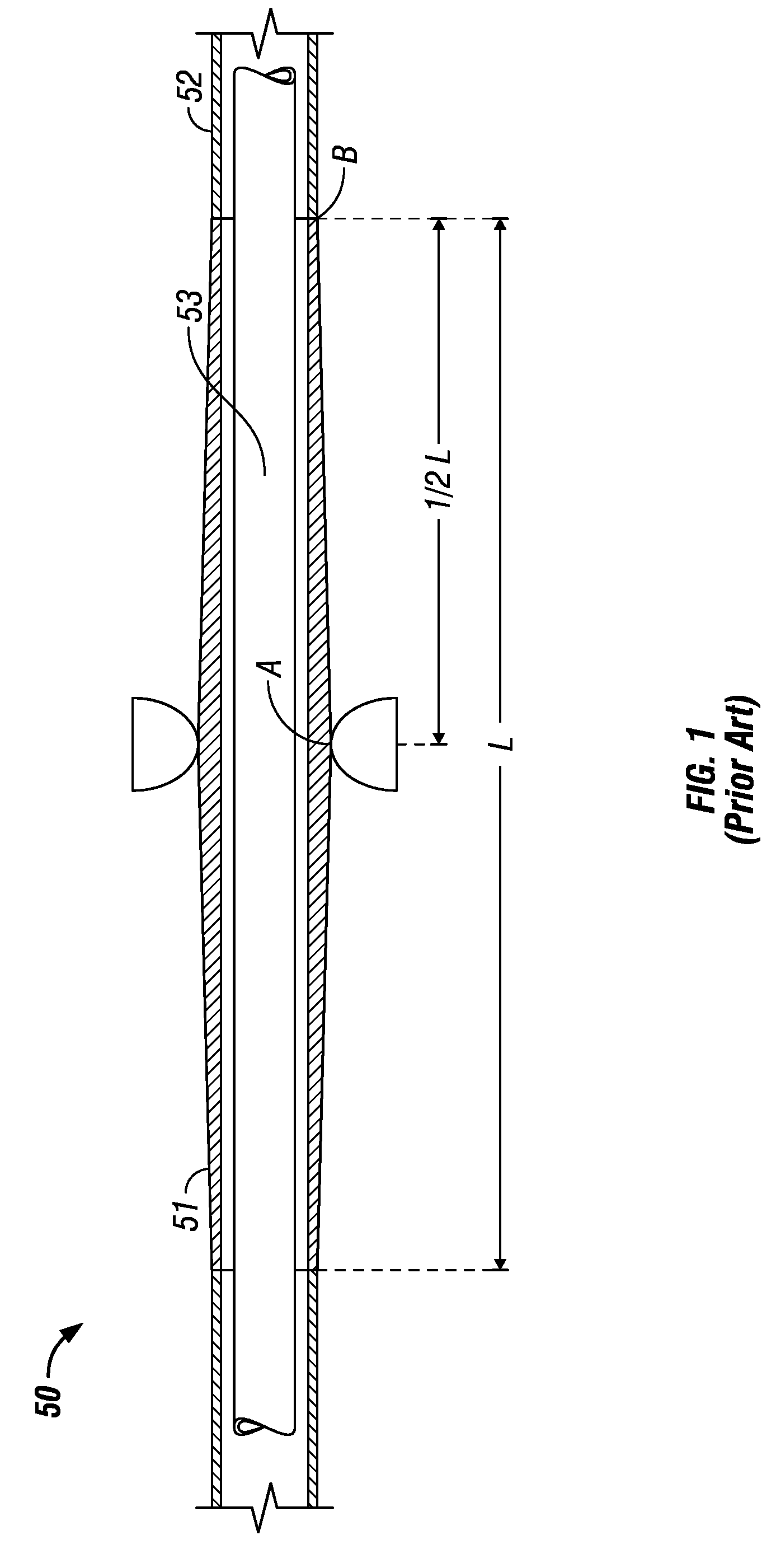 Pull tube sleeve stress joint for floating offshore structure