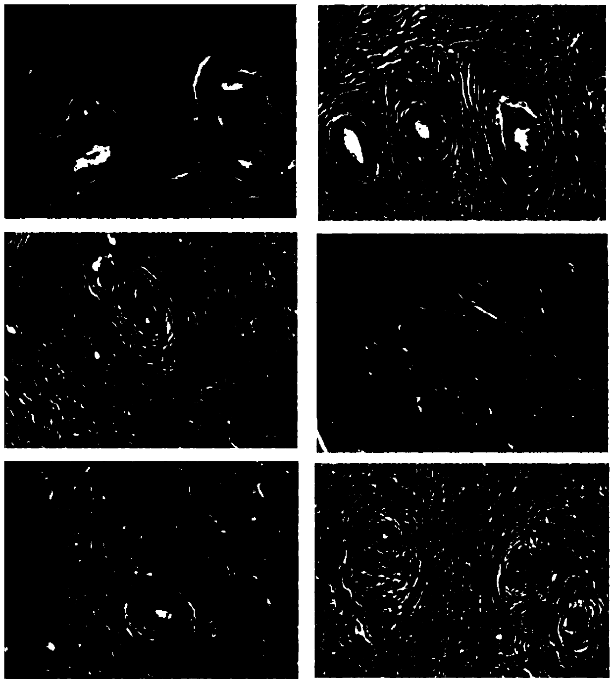 A kind of traditional Chinese medicine preparation for treating uterine fibroids and preparation method thereof