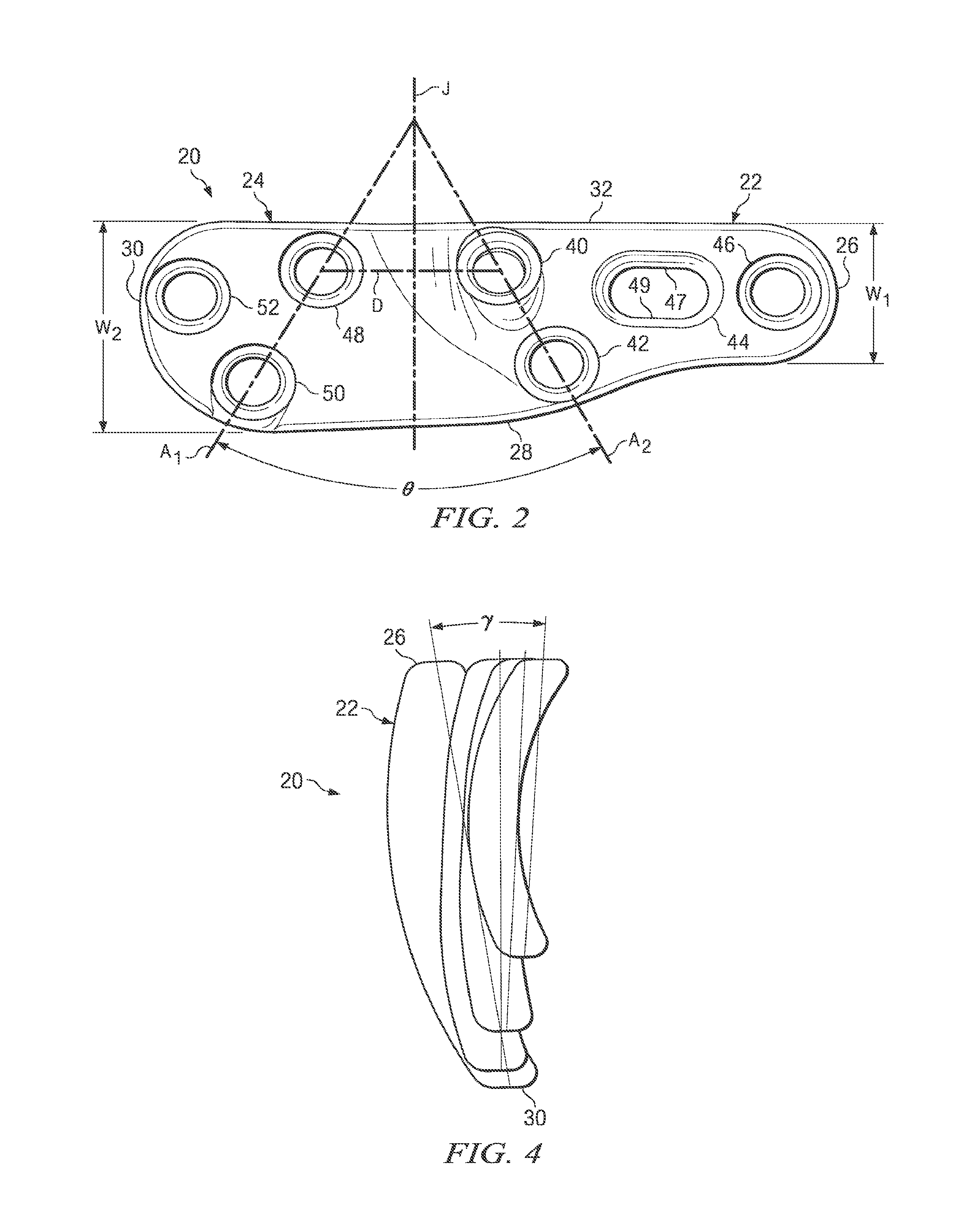 Fixation plate for use in the lapidus approach