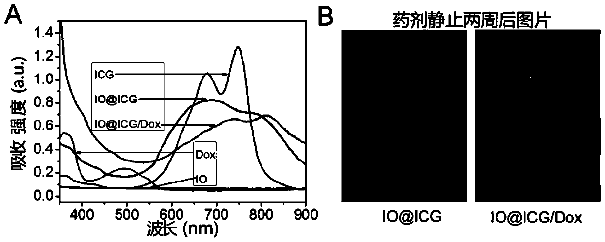 Medicine-lipiodol solvent and preparation method thereof