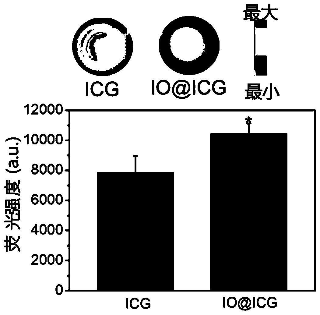 Medicine-lipiodol solvent and preparation method thereof