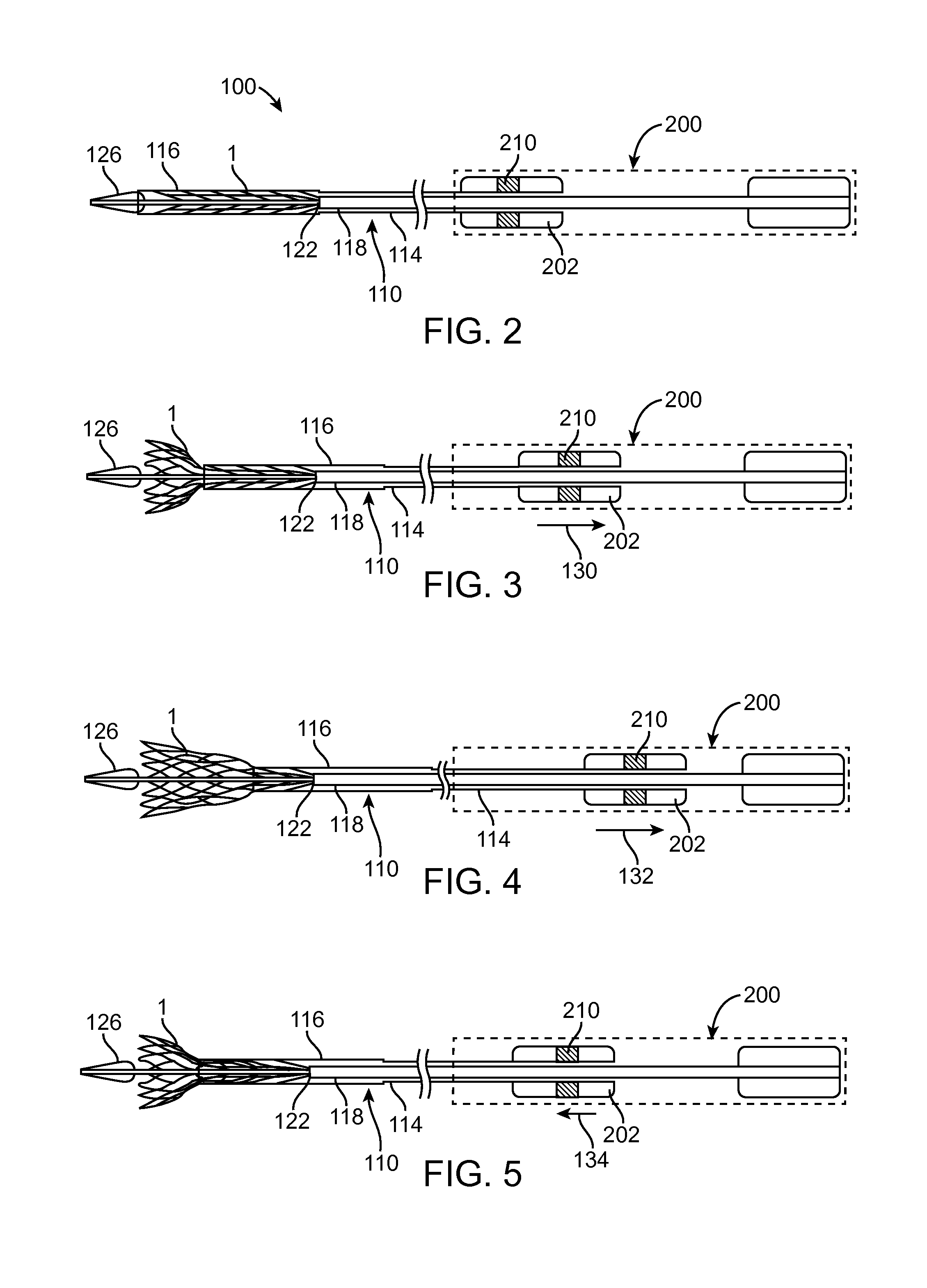 Transcatheter Valve Prosthesis Delivery System With Recapturing Feature and Method