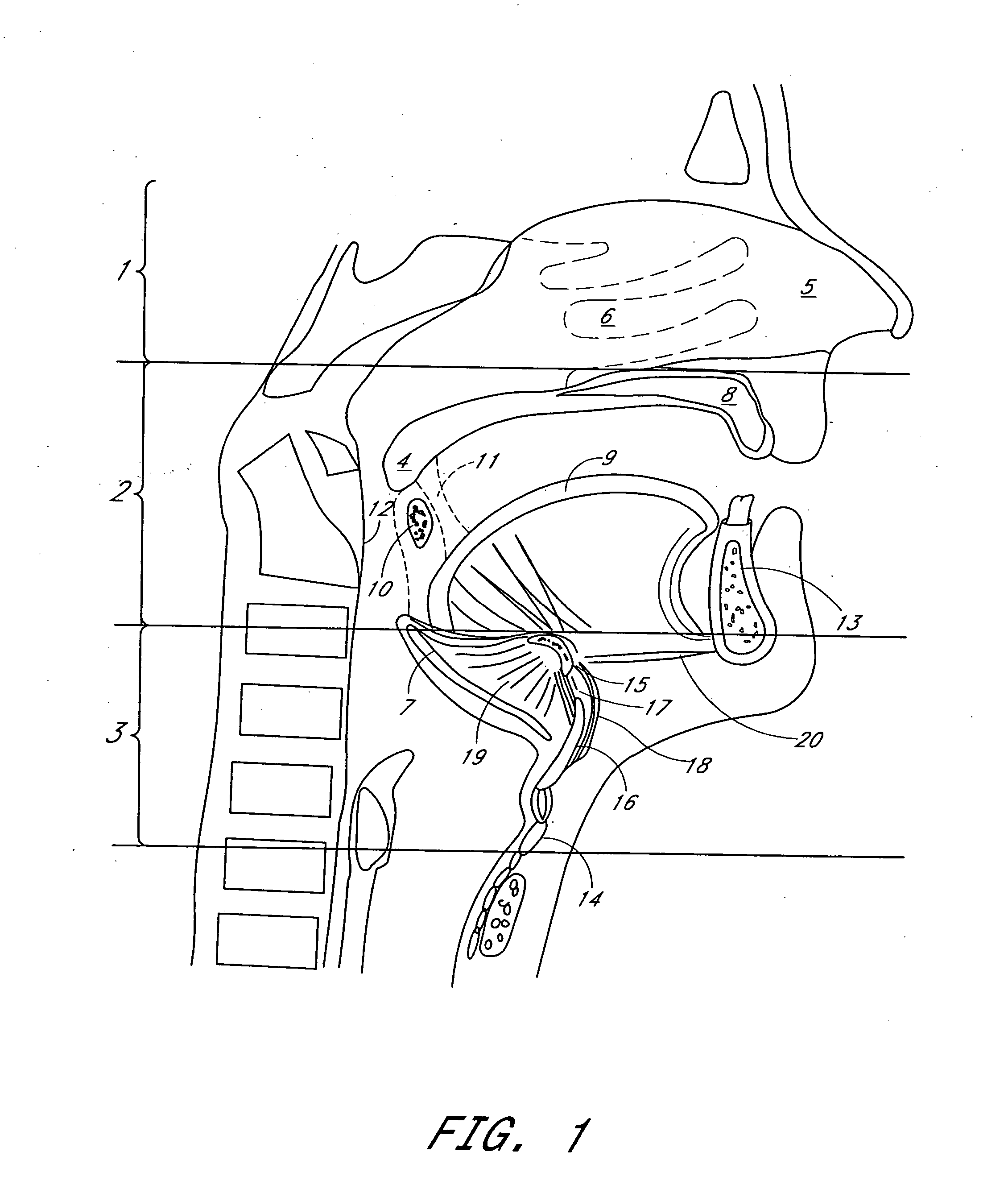 System and method for airway manipulation