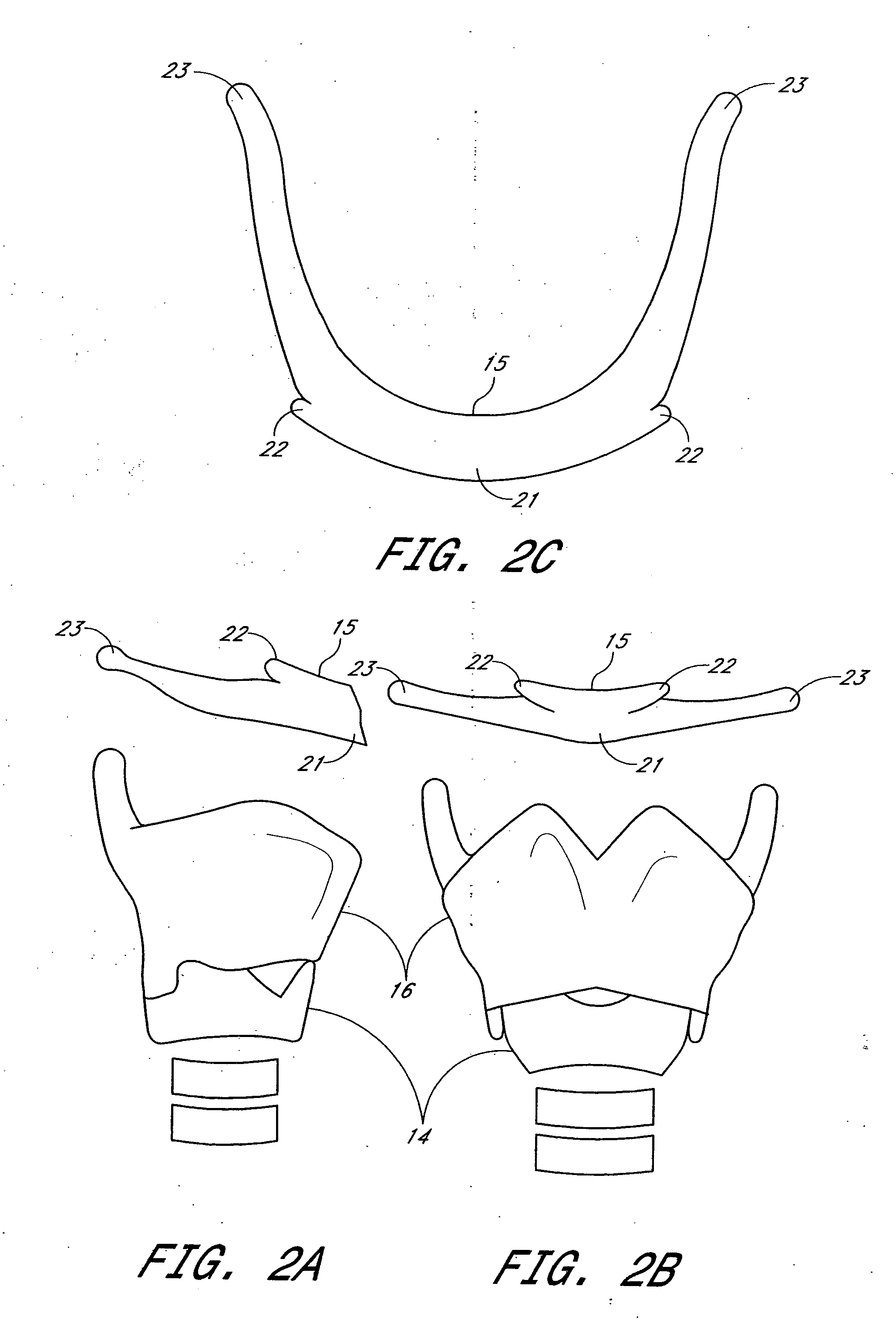 System and method for airway manipulation