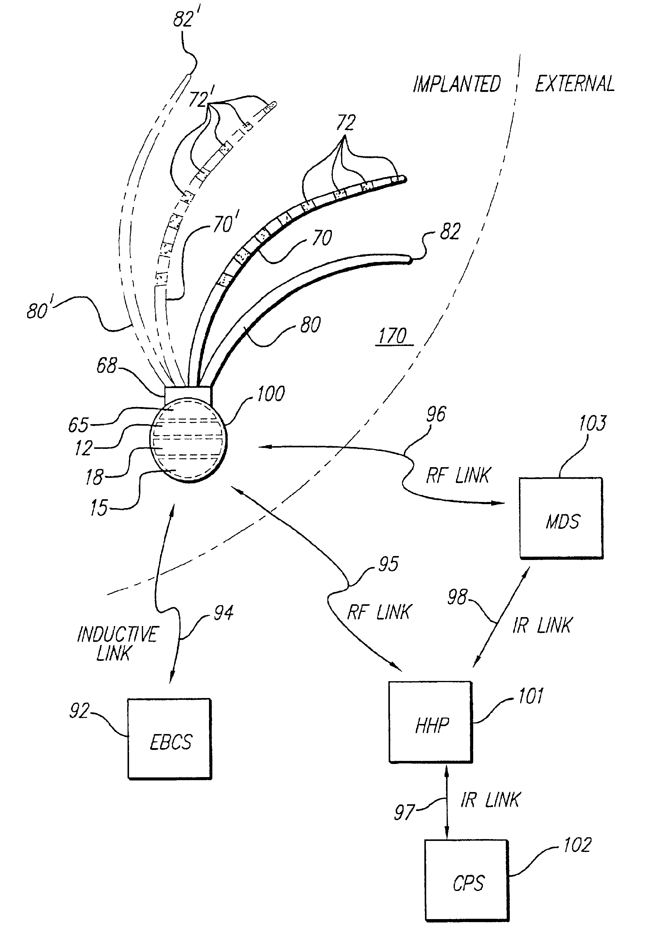 Implantable stimulator methods for treatment of incontinence and pain