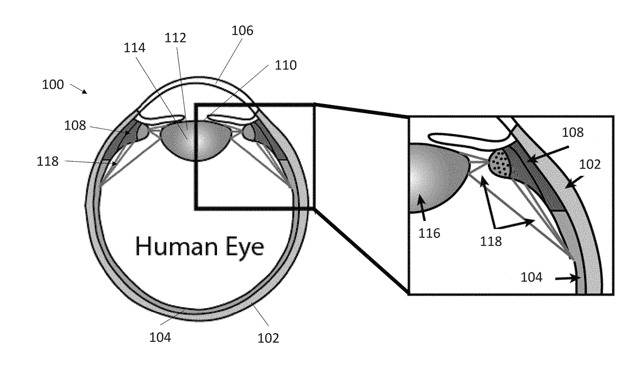 3-dimensional model creation using whole eye finite element modeling of human ocular structures