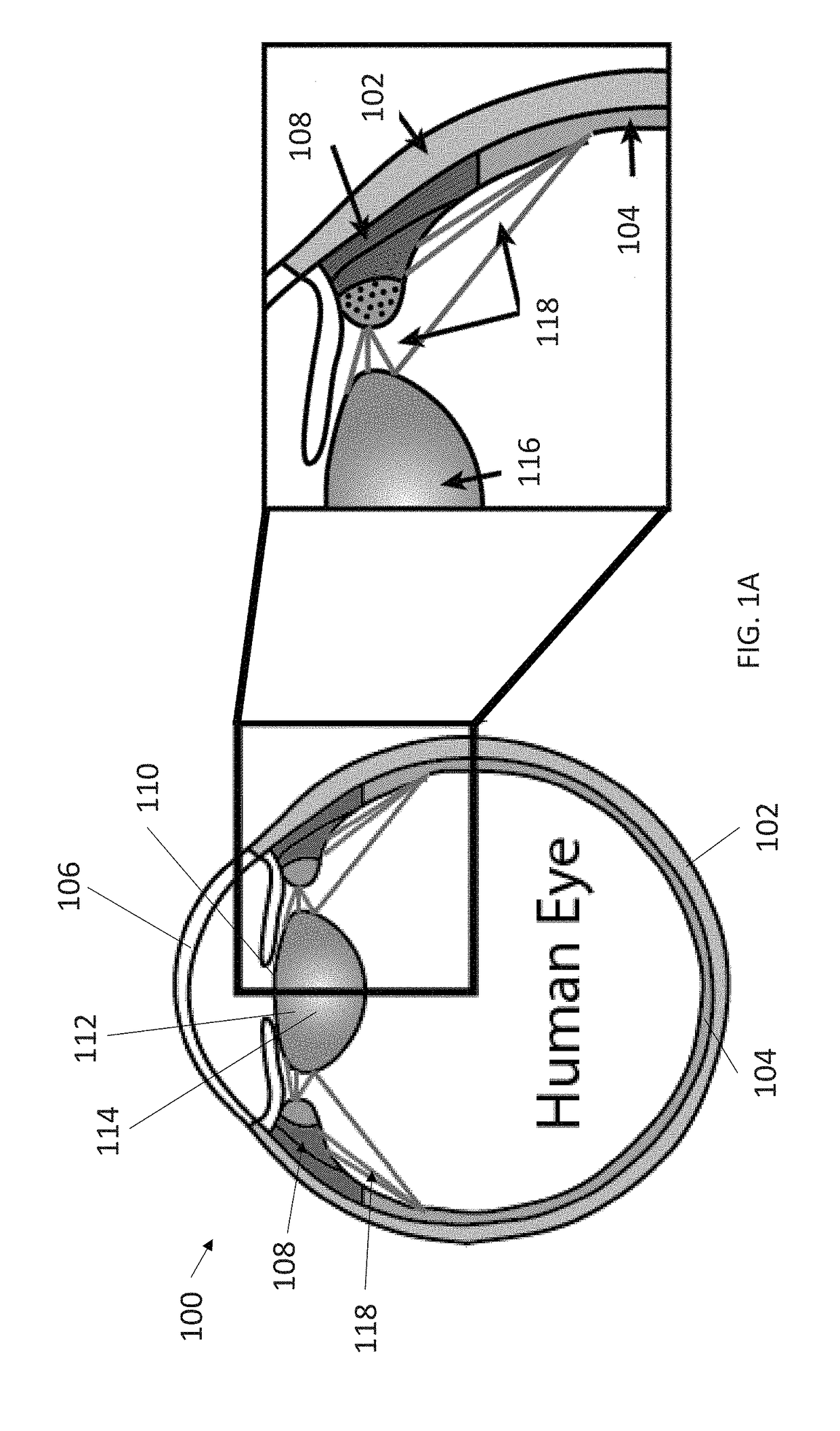 3-dimensional model creation using whole eye finite element modeling of human ocular structures