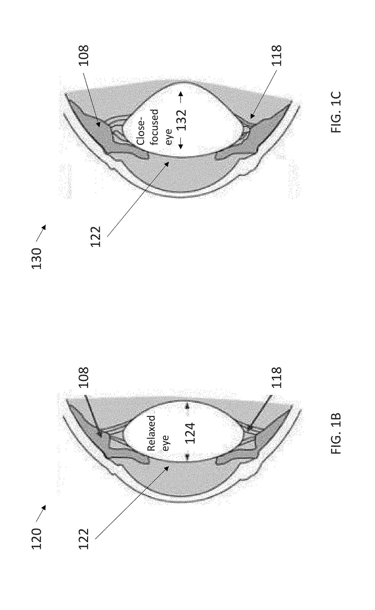 3-dimensional model creation using whole eye finite element modeling of human ocular structures