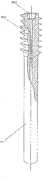 Hollow titanium rod for supporting collapse of femoral head