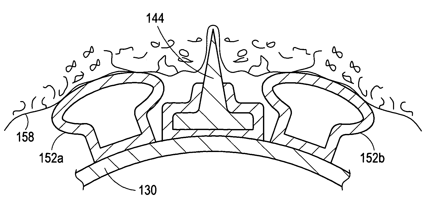 Cutting balloon having sheathed incising elements