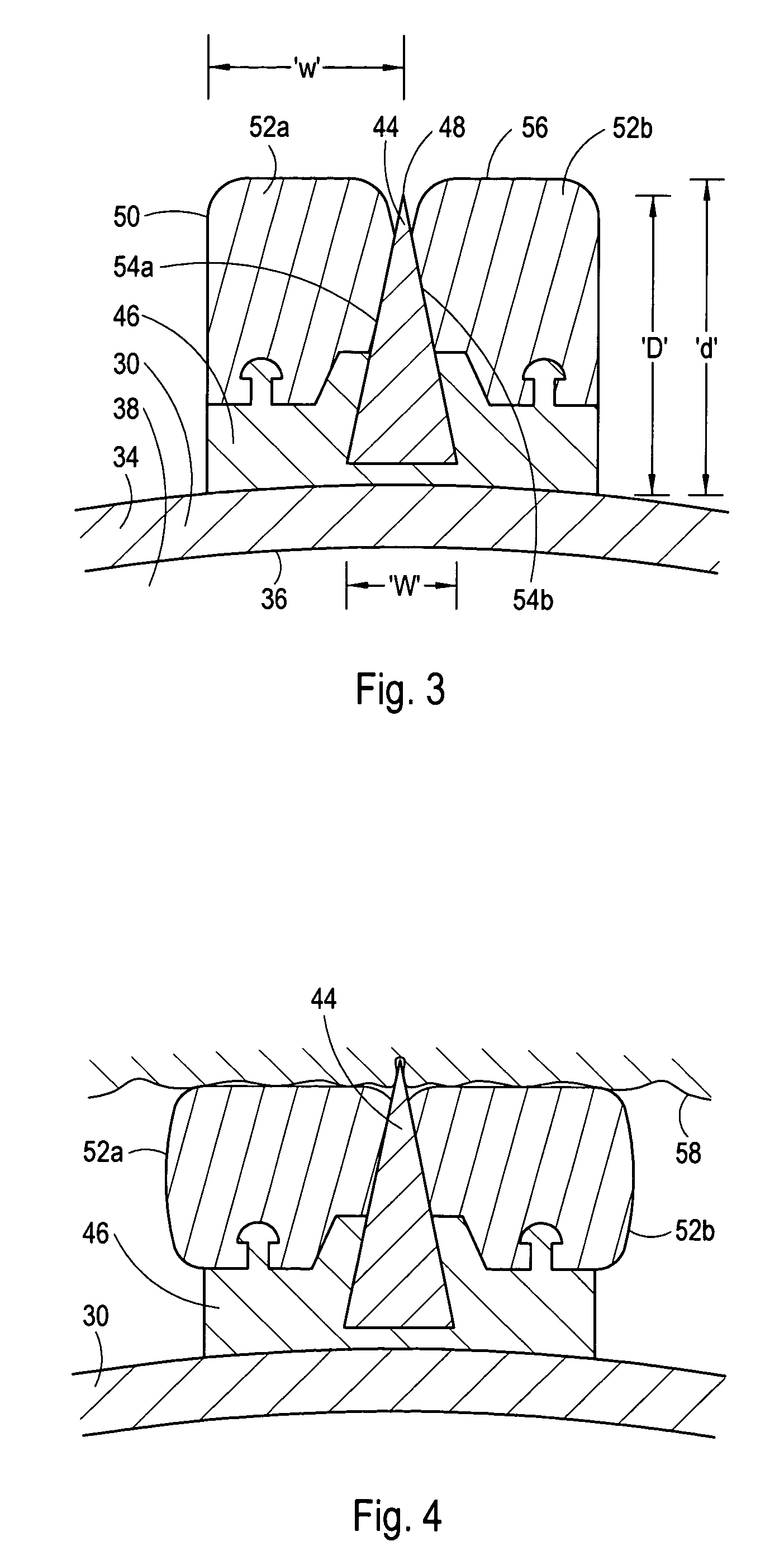 Cutting balloon having sheathed incising elements