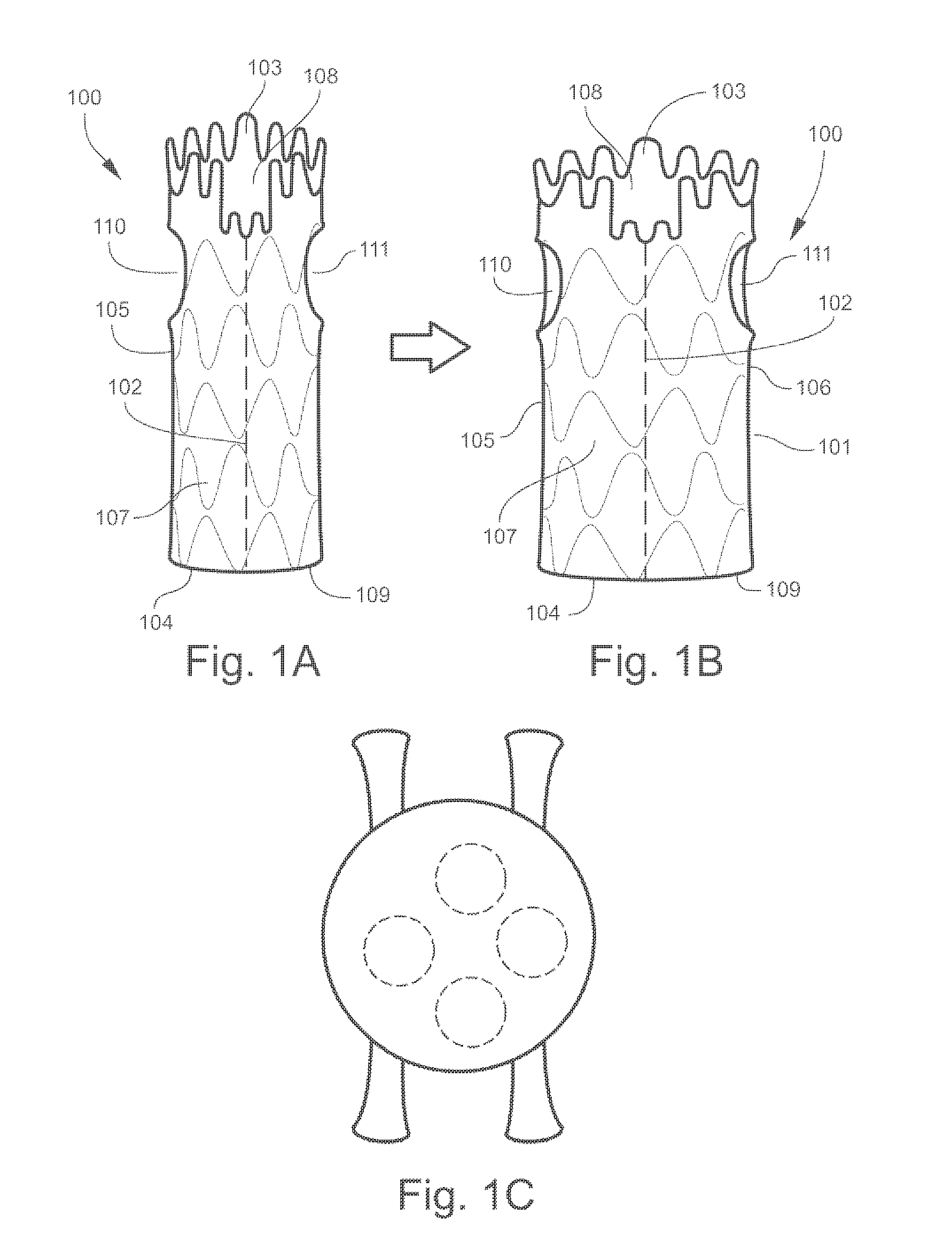 Universal endovascular grafts