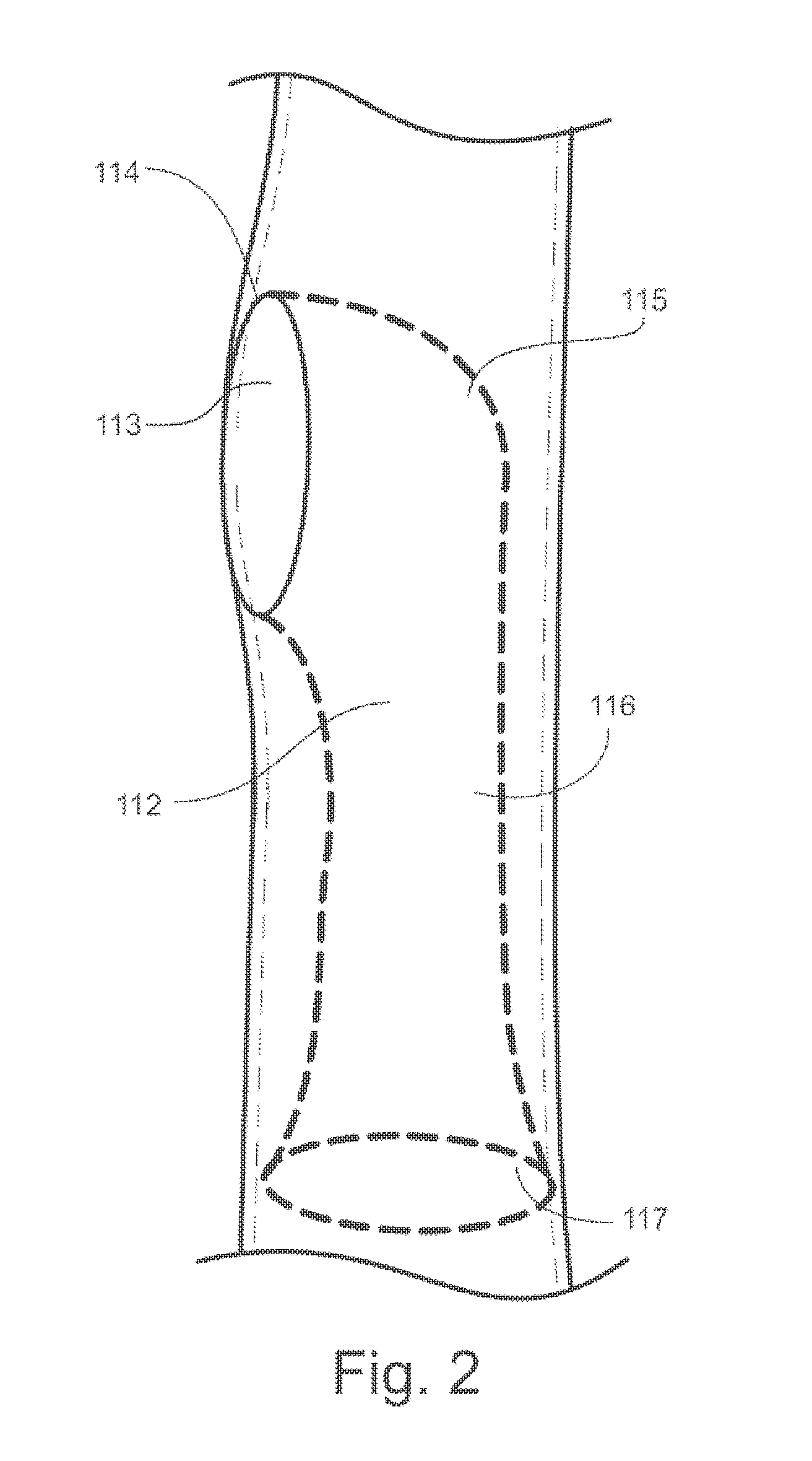 Universal endovascular grafts