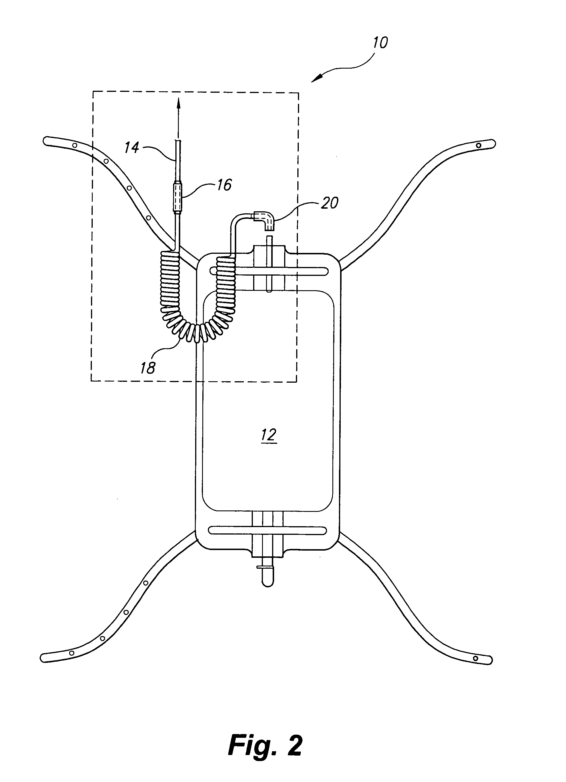 External catheter tube