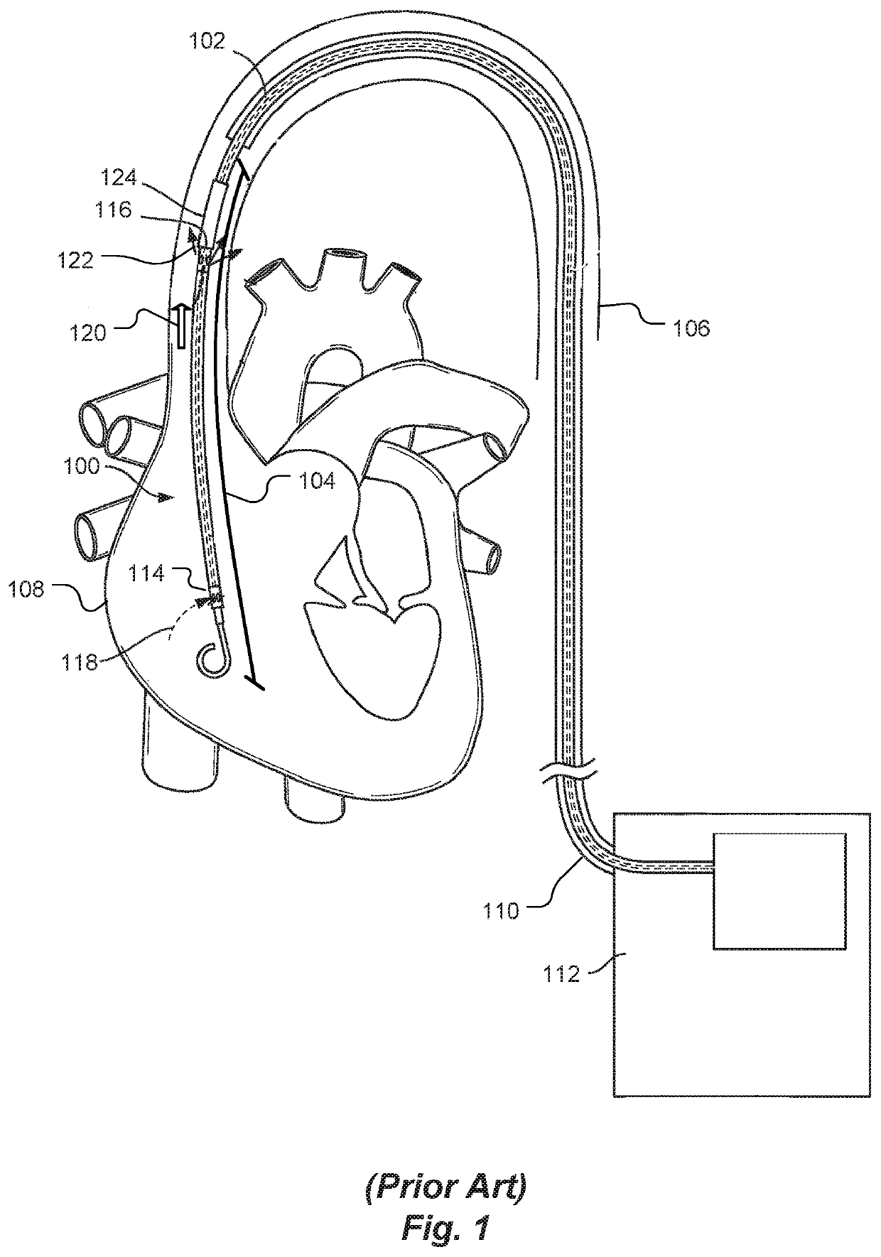 Blood Flow Rate Measurement System