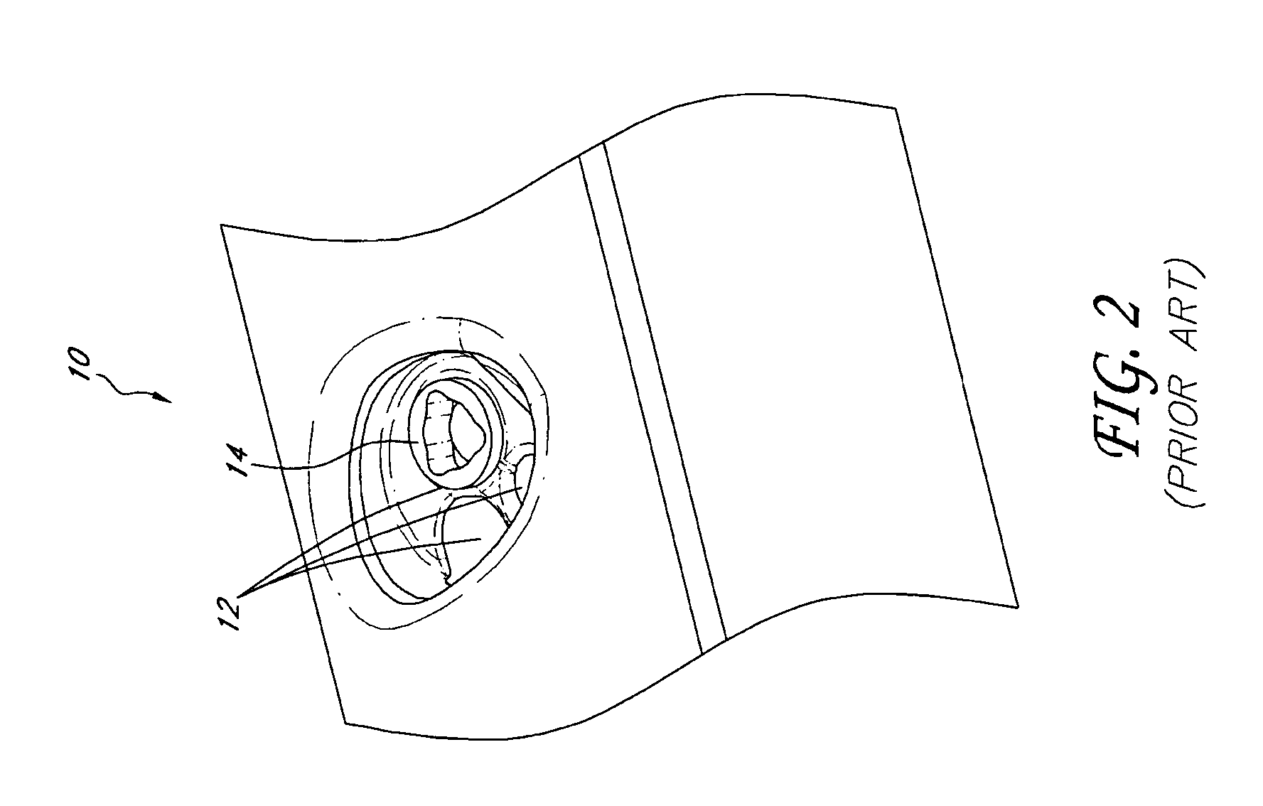 Device and procedure for implanting a dental implant