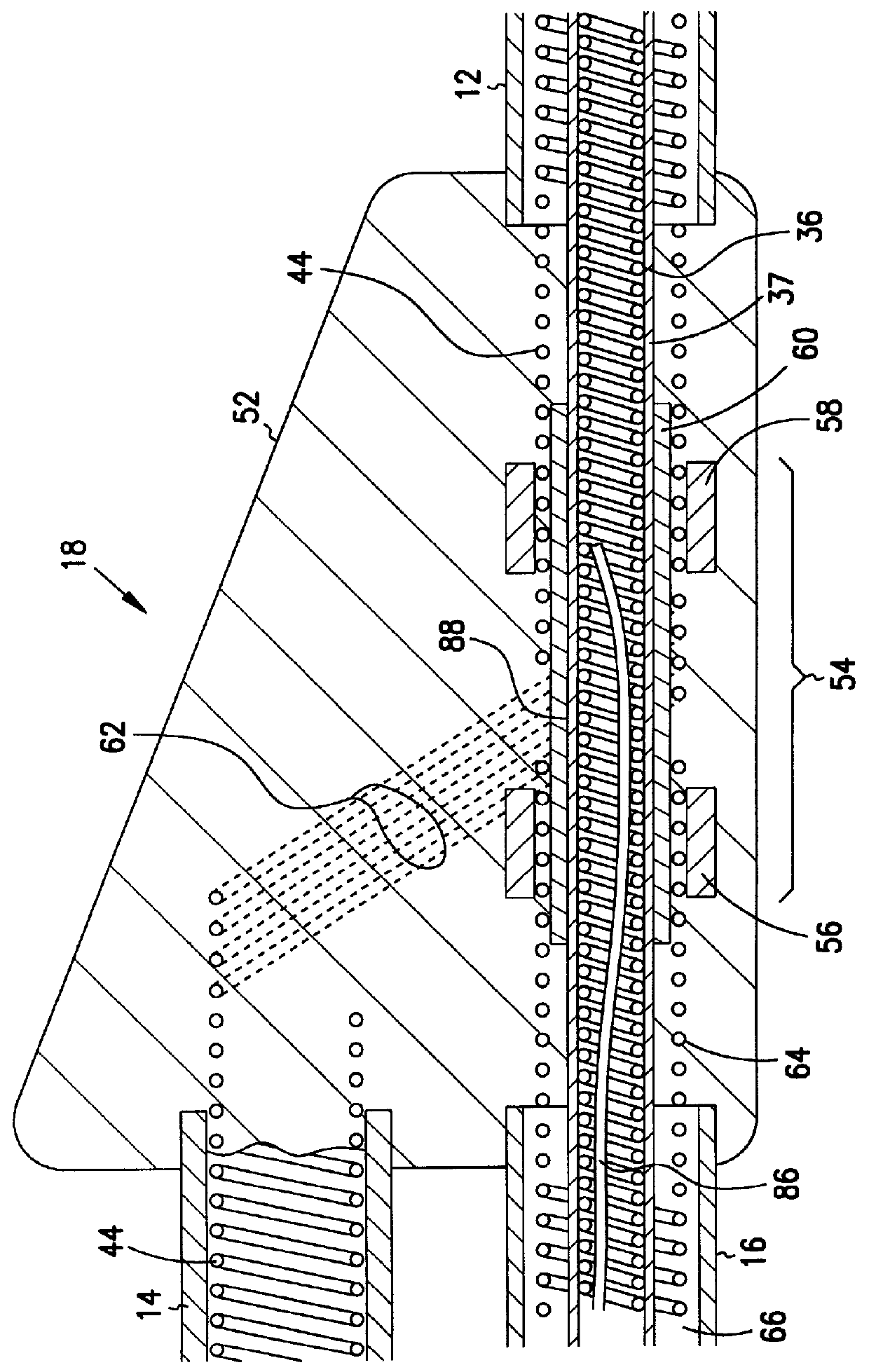 Cardiac lead with ETEE coated DBS coil