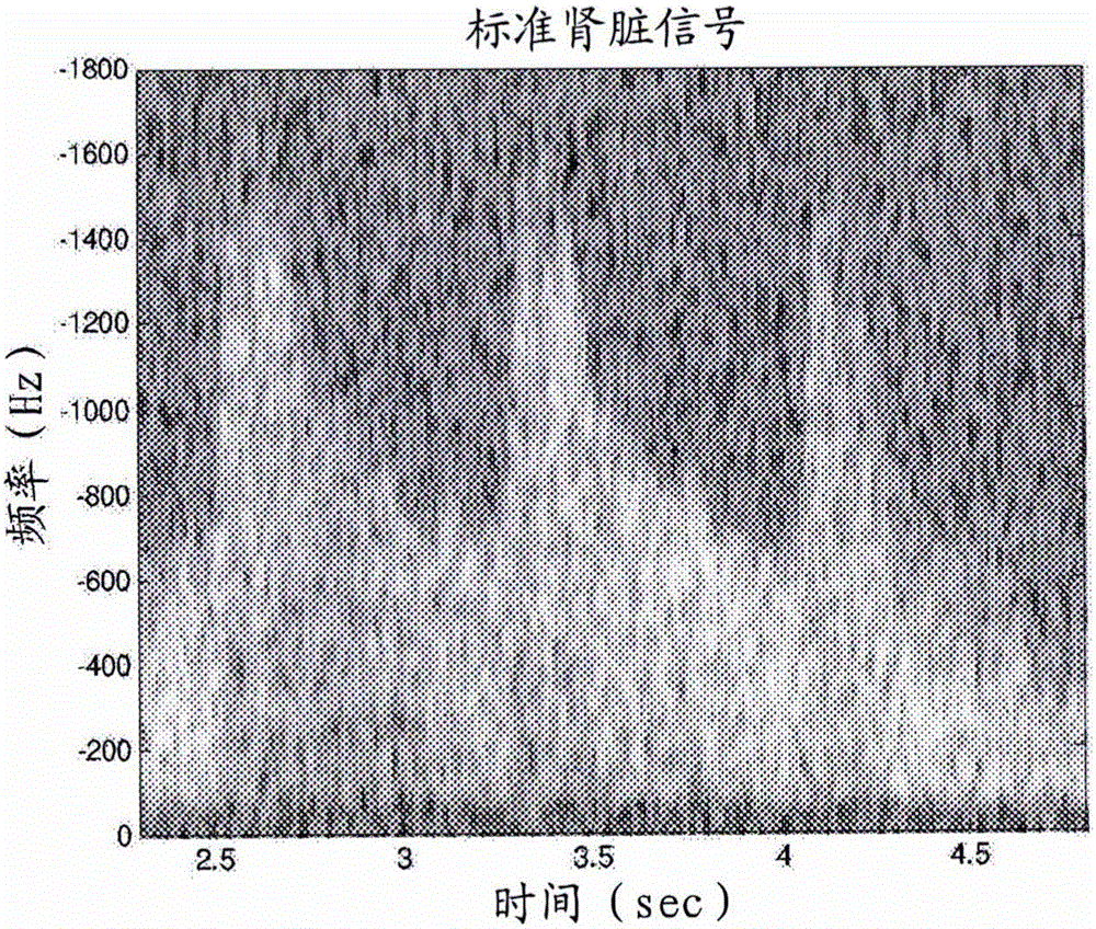 Doppler Imaging