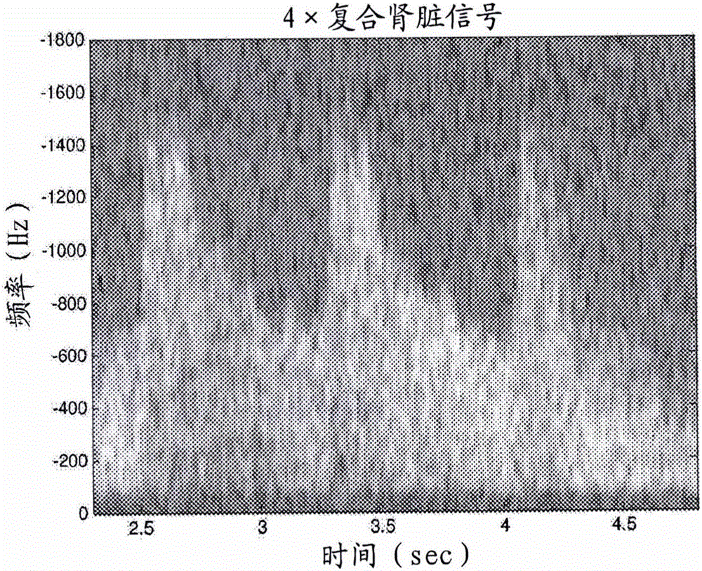 Doppler Imaging